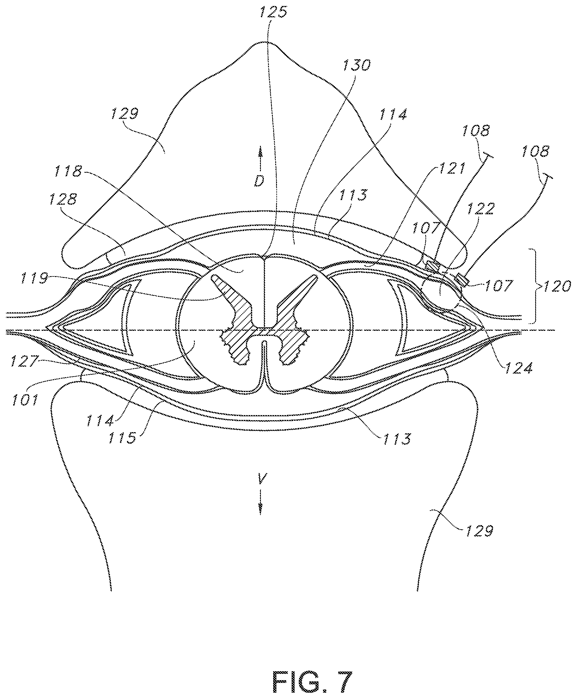 Patent US11793443 Figure 7 – Adjustable random electrical stimulation technologies