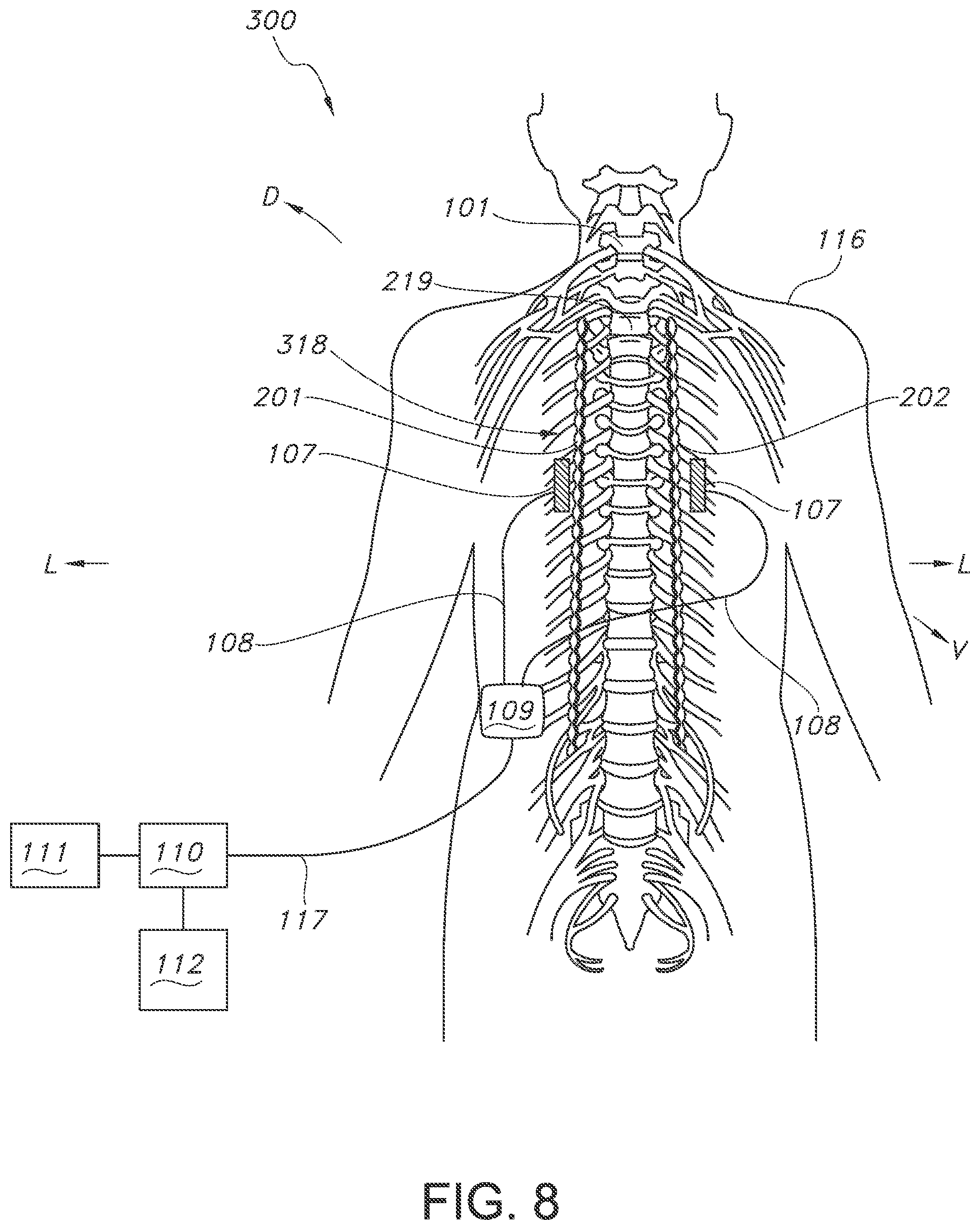 Patent US11793443 Figure 8 – Adjustable random electrical stimulation technologies