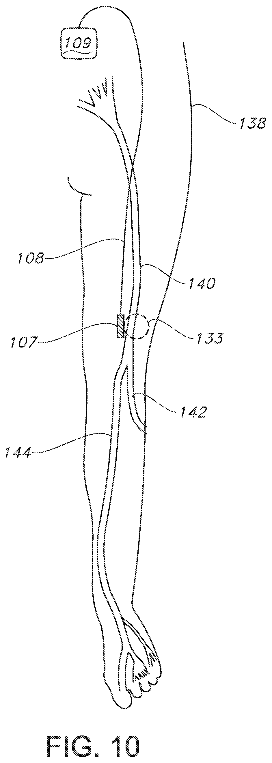 Patent US11793443 Figure 10 – Adjustable random electrical stimulation technologies