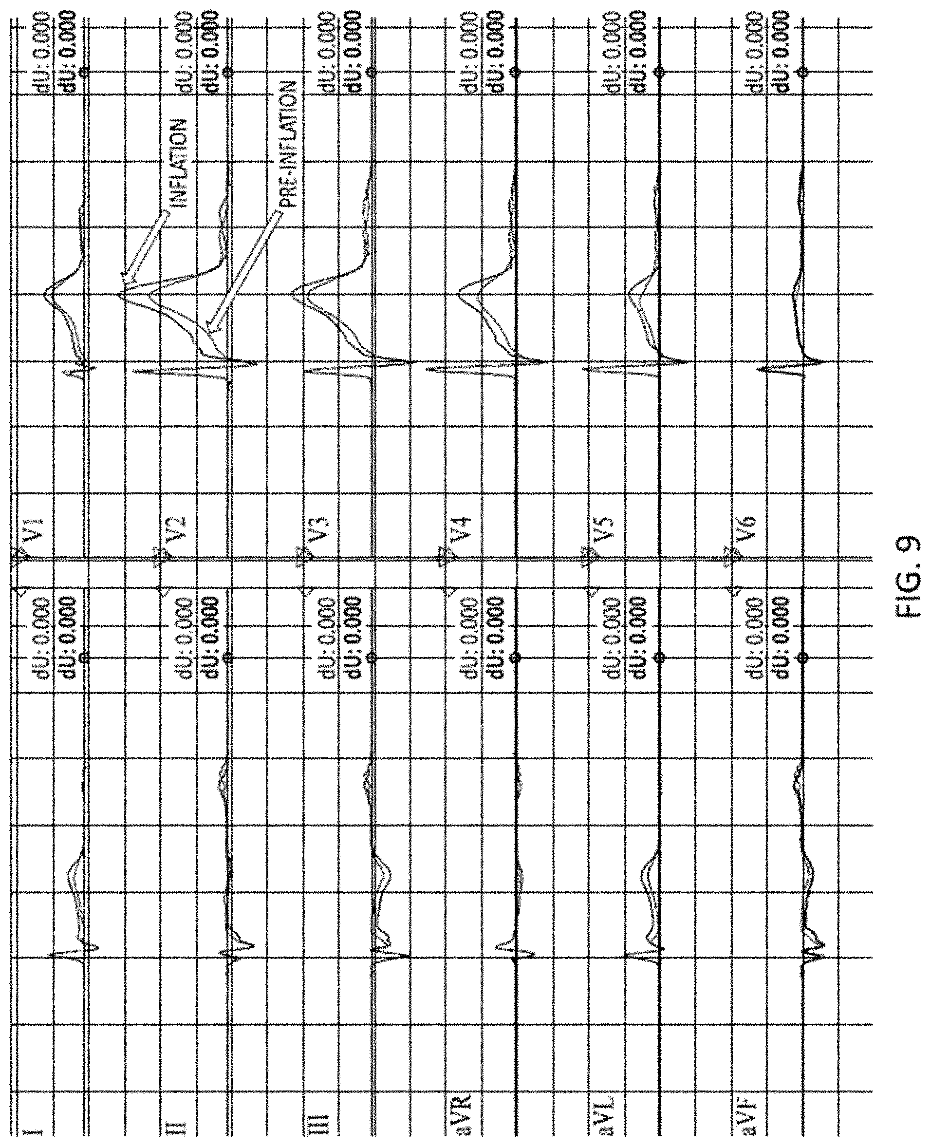 Patent US11793444 Figure 7 – Electrocardiogram patch devices and methods