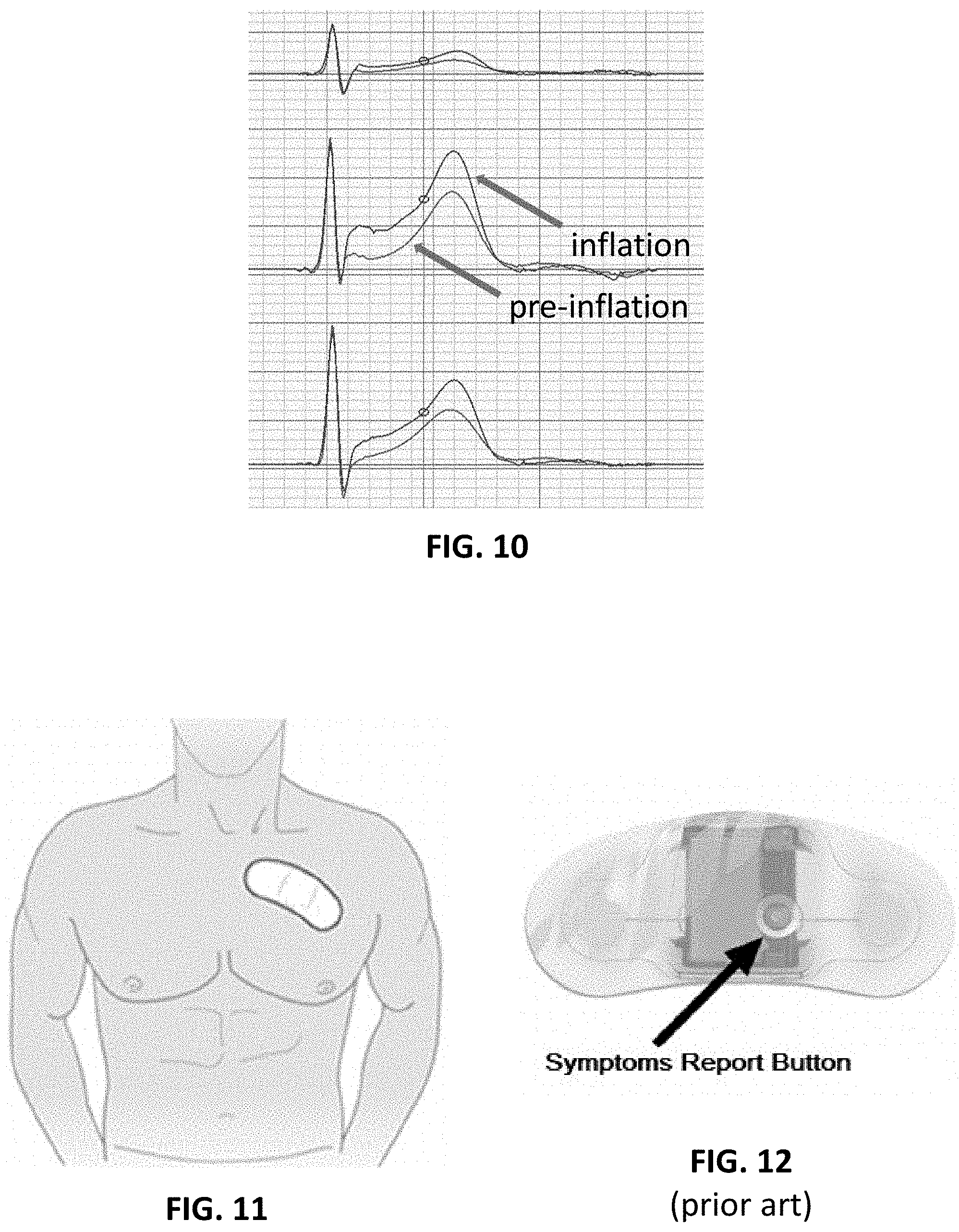 Patent US11793444 Figure 8 – Electrocardiogram patch devices and methods