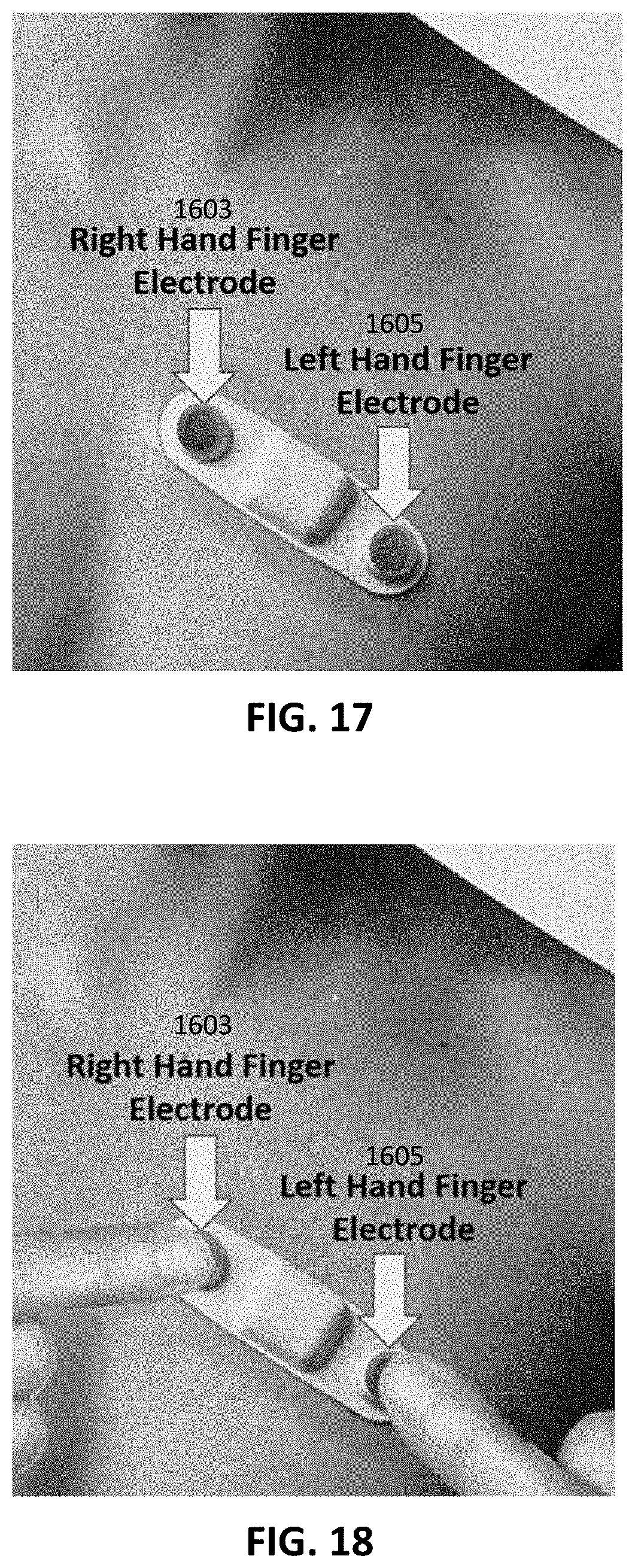 Patent US11793444 Figure 11 – Electrocardiogram patch devices and methods