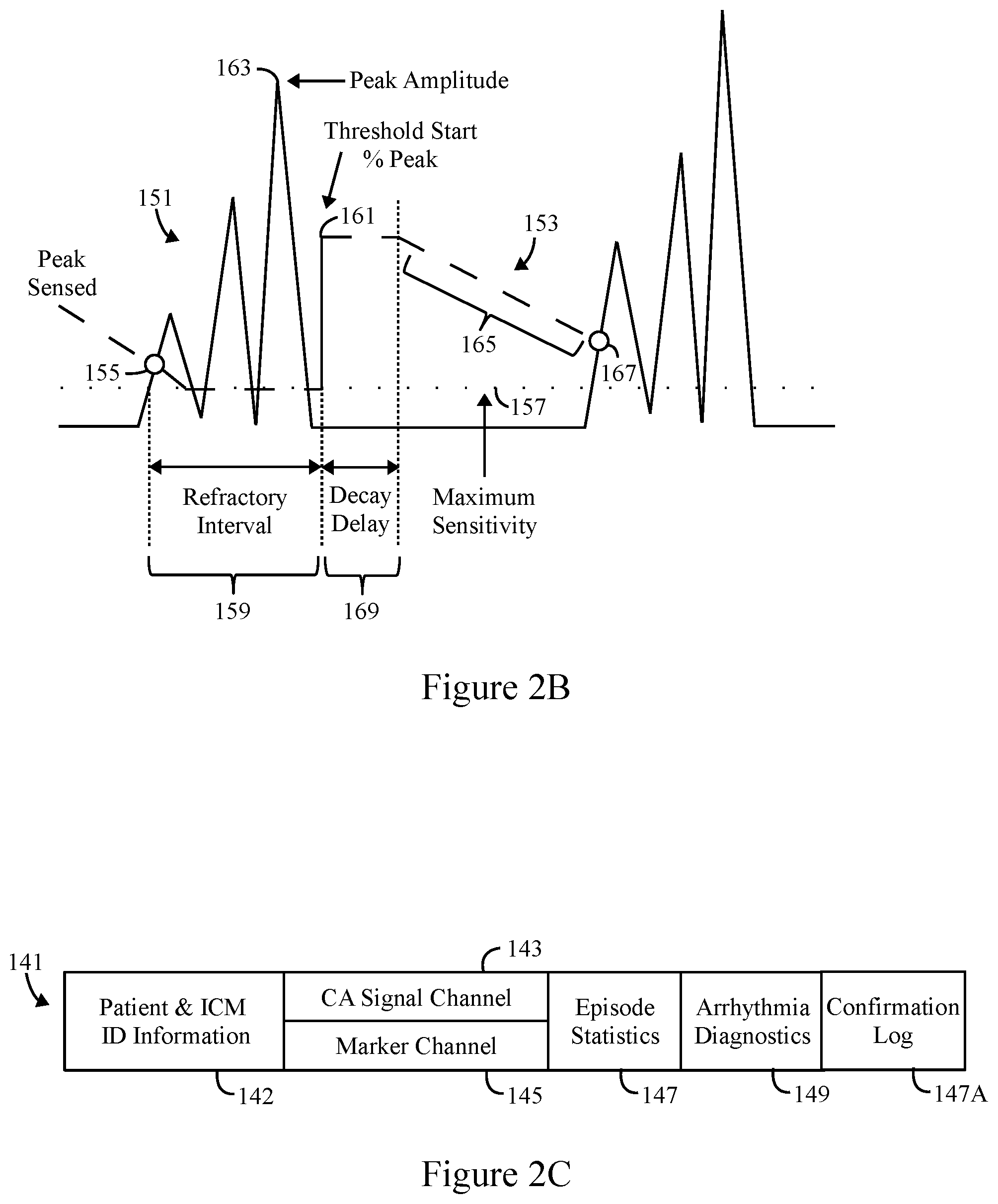 Patent US11793445 Figure 3 – Method and system to detect P-waves in cardiac arrhythmic patterns
