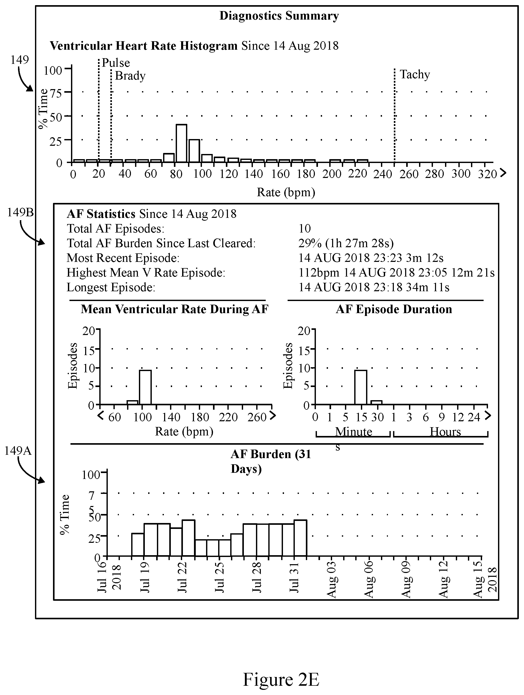 Patent US11793445 Figure 5 – Method and system to detect P-waves in cardiac arrhythmic patterns