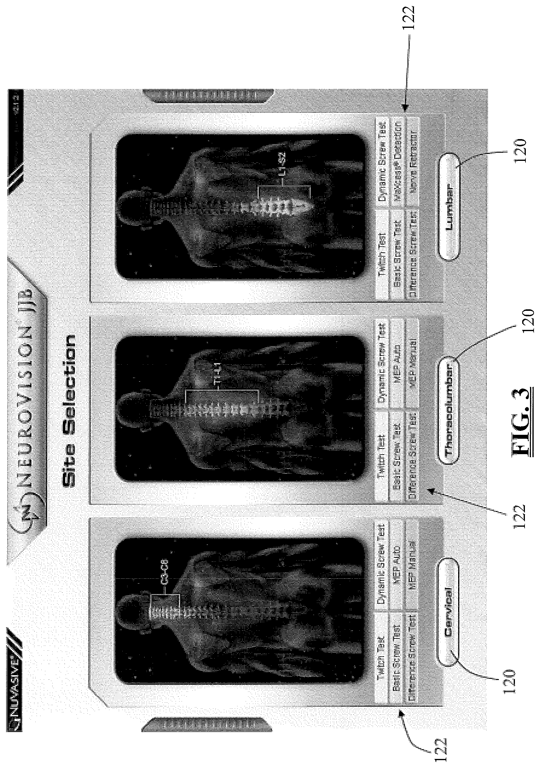 Patent US11793447 Figure 3 – System and methods for performing neurophysiologic assessments during spine surgery