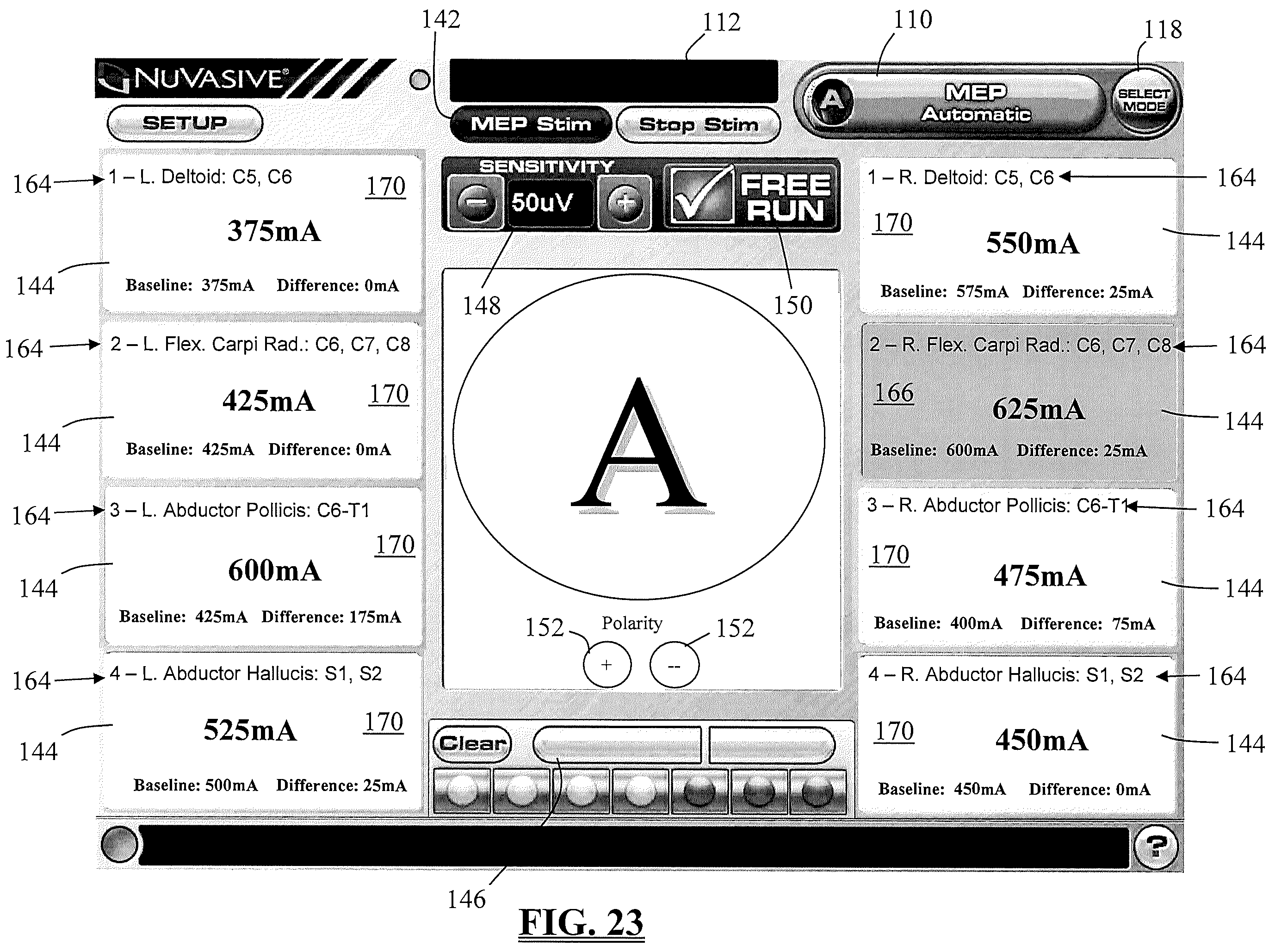 Patent US11793447 Figure 19 – System and methods for performing neurophysiologic assessments during spine surgery