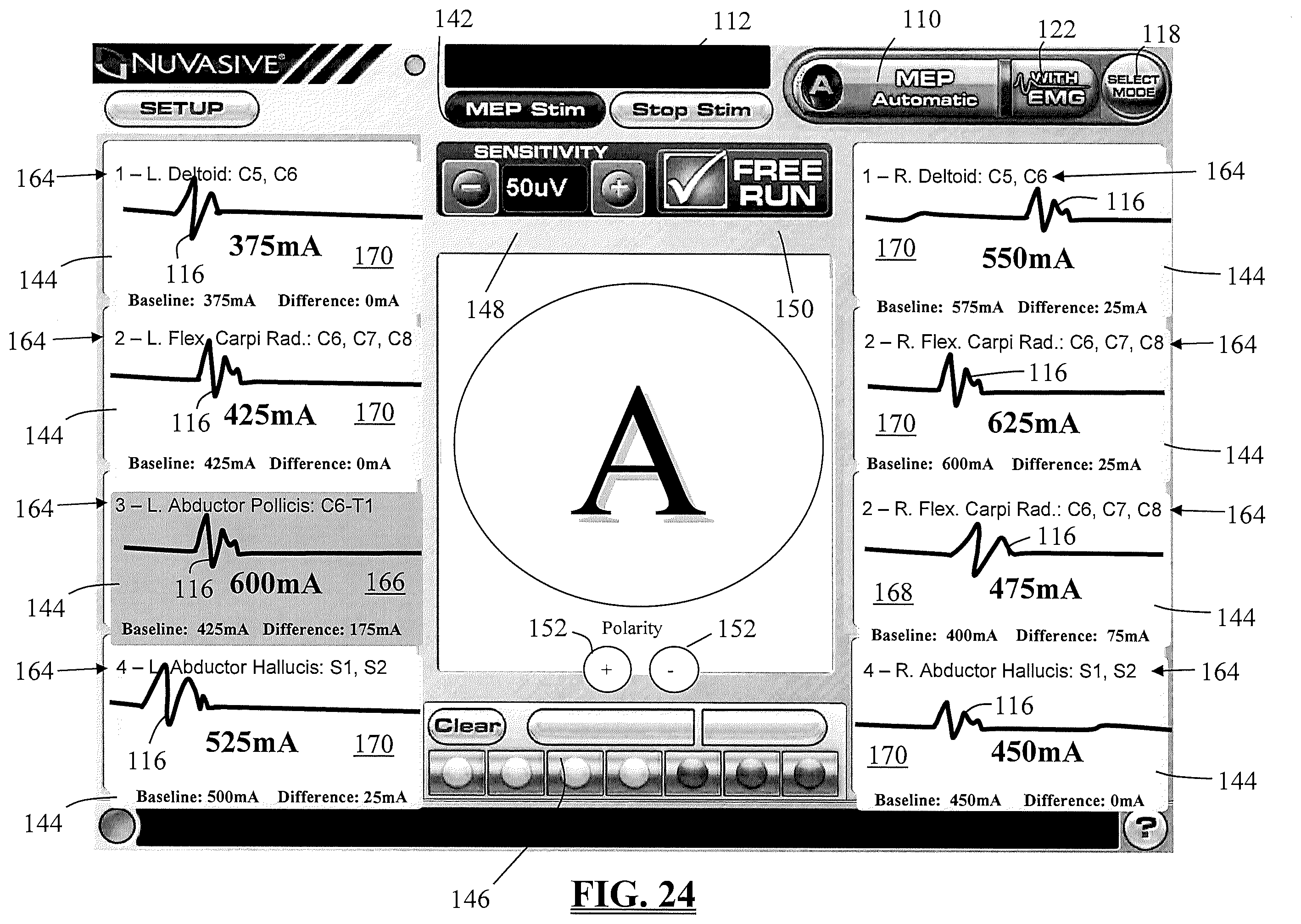 Patent US11793447 Figure 20 – System and methods for performing neurophysiologic assessments during spine surgery