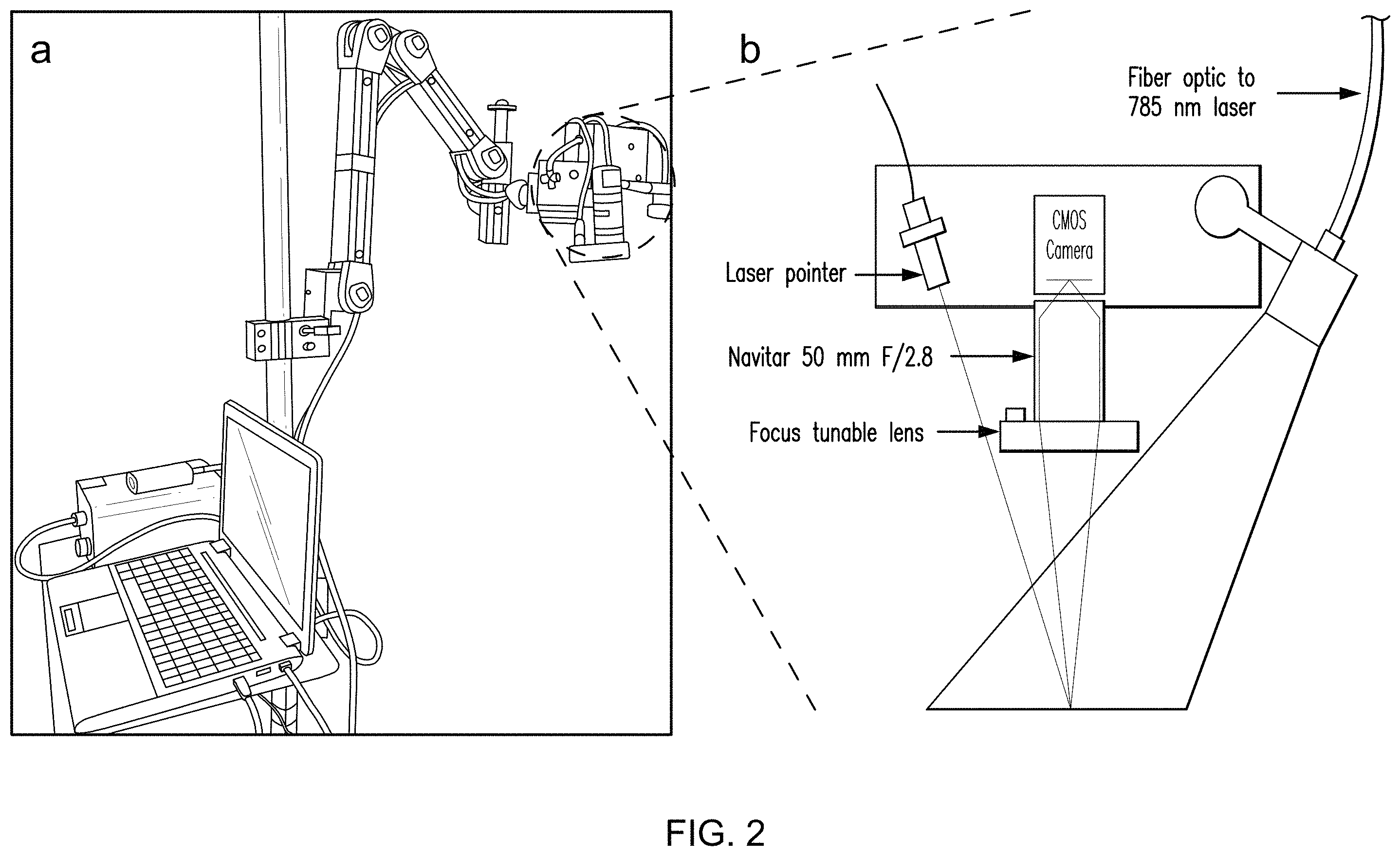 Patent US11793450 Figure 2 – Methods and apparatus for intraoperative assessment of parathyroid gland vascularity using laser speckle contrast imaging and applications of same
