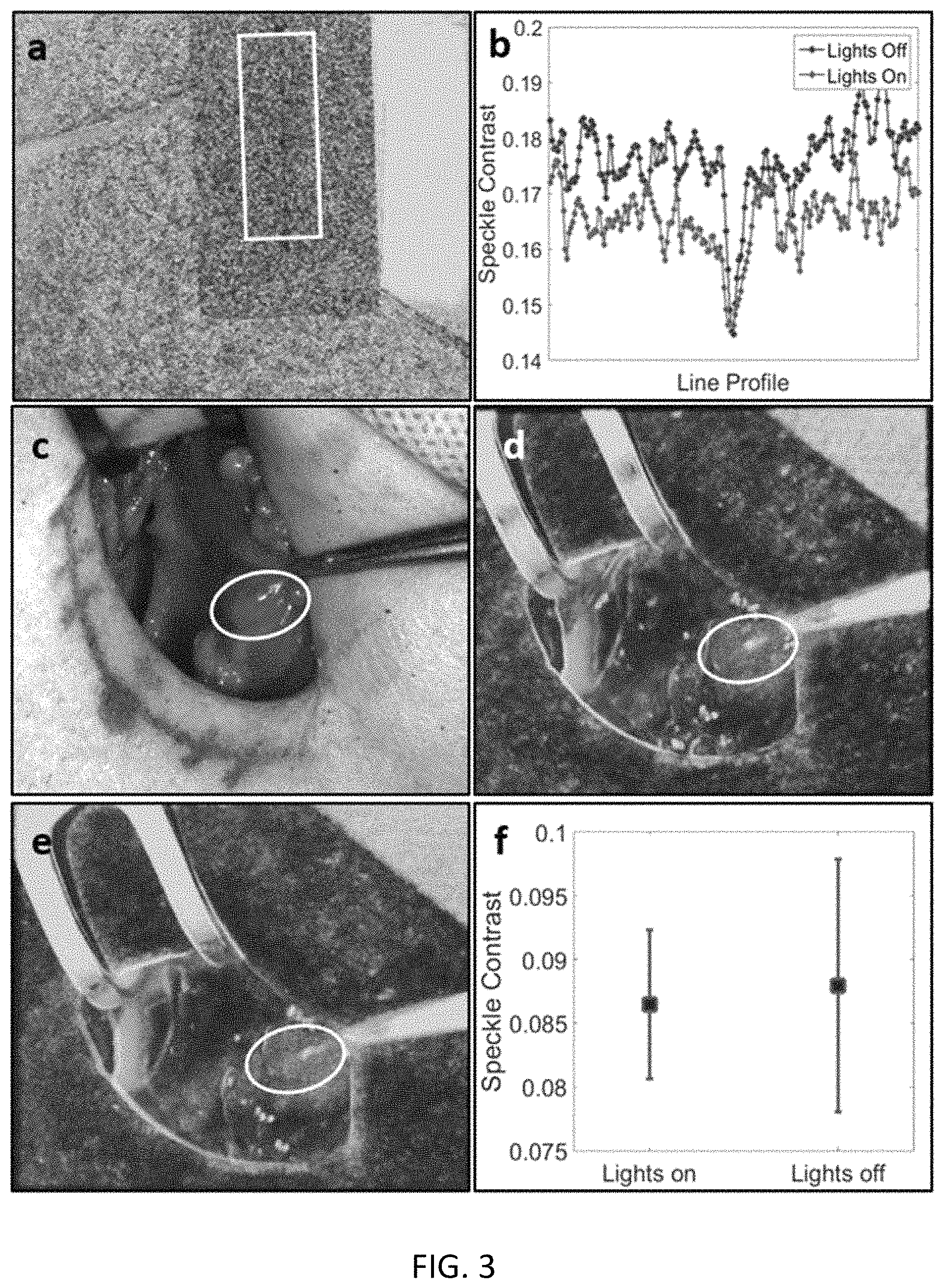 Patent US11793450 Figure 3 – Methods and apparatus for intraoperative assessment of parathyroid gland vascularity using laser speckle contrast imaging and applications of same