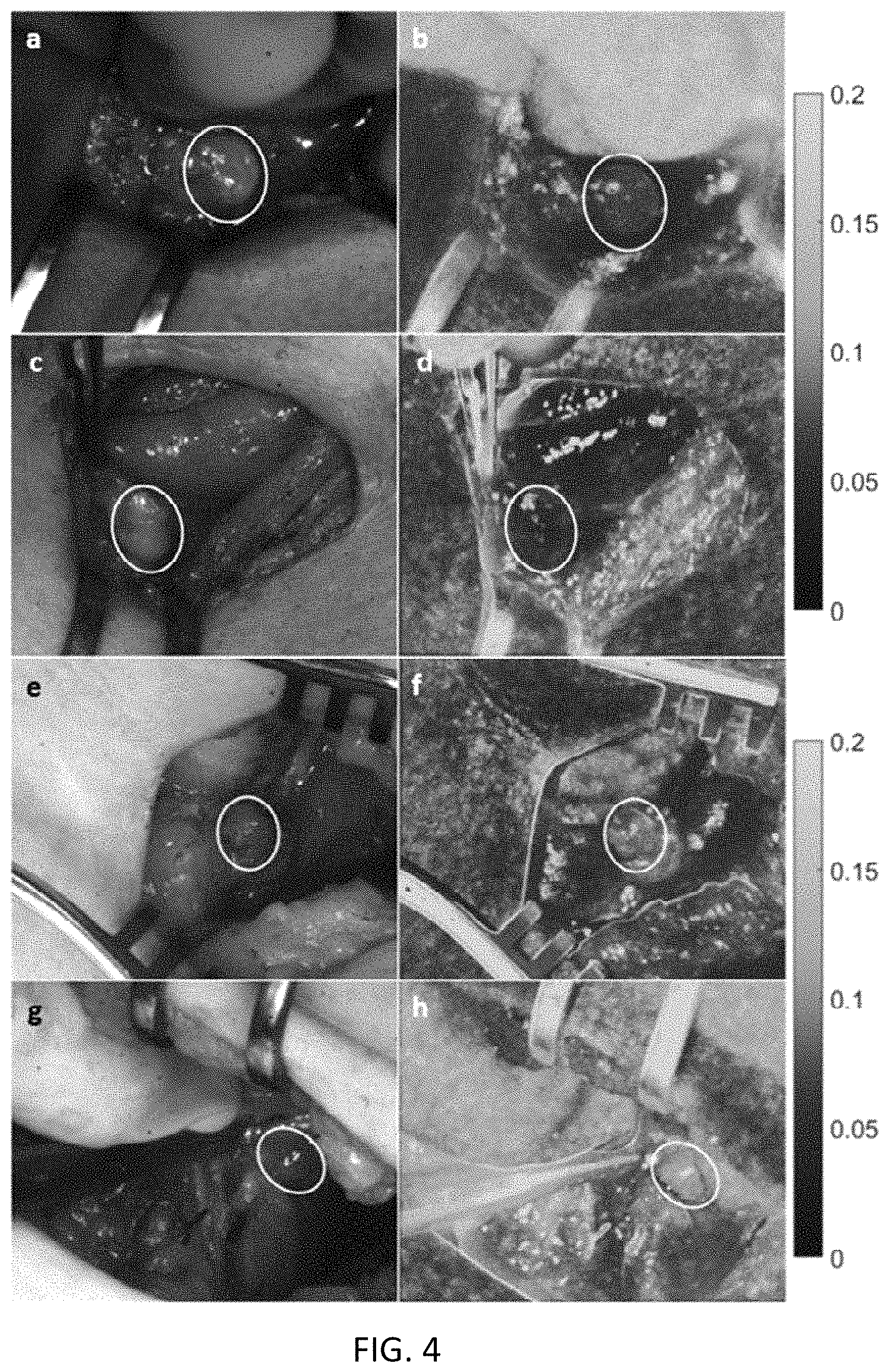 Patent US11793450 Figure 4 – Methods and apparatus for intraoperative assessment of parathyroid gland vascularity using laser speckle contrast imaging and applications of same