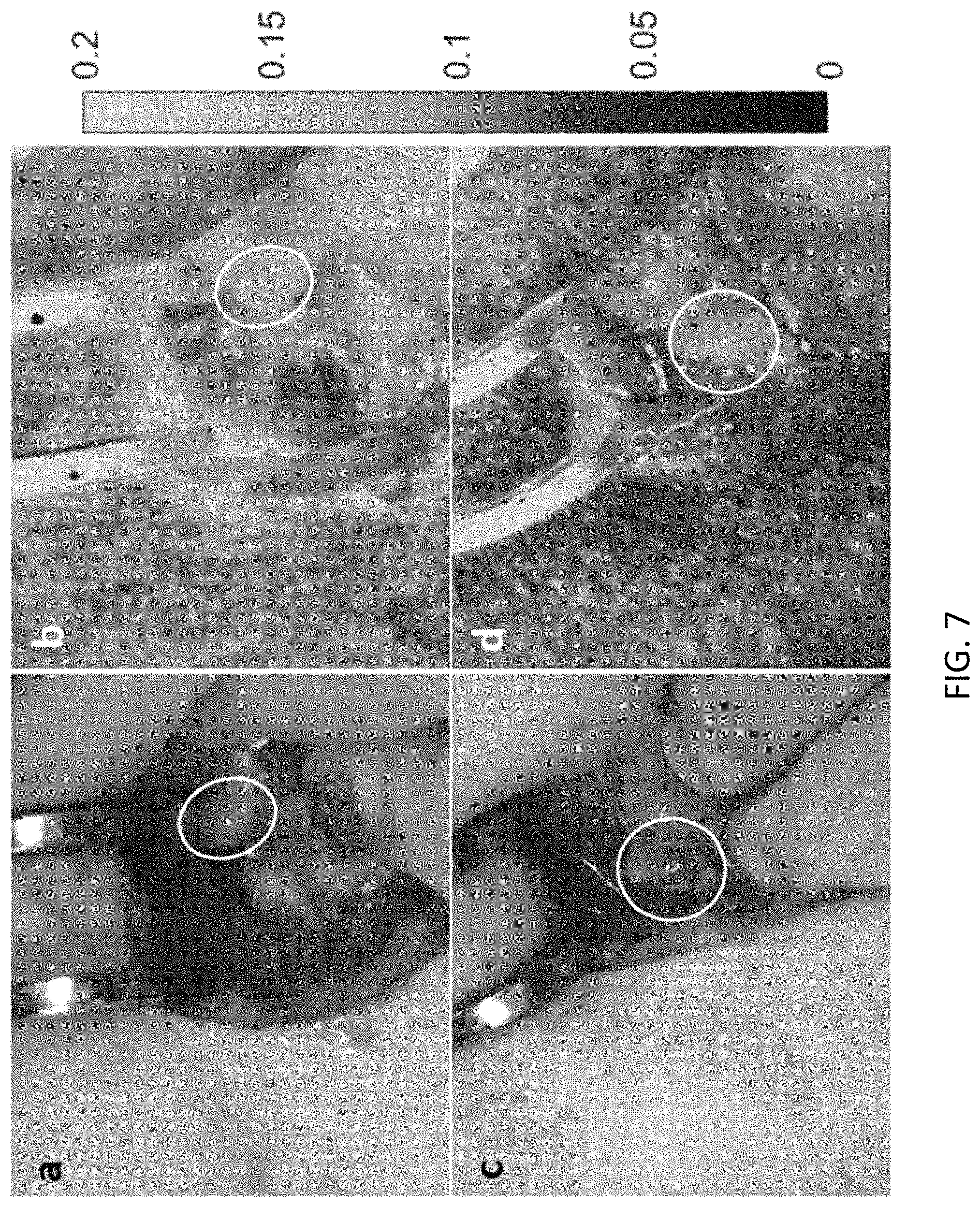 Patent US11793450 Figure 7 – Methods and apparatus for intraoperative assessment of parathyroid gland vascularity using laser speckle contrast imaging and applications of same