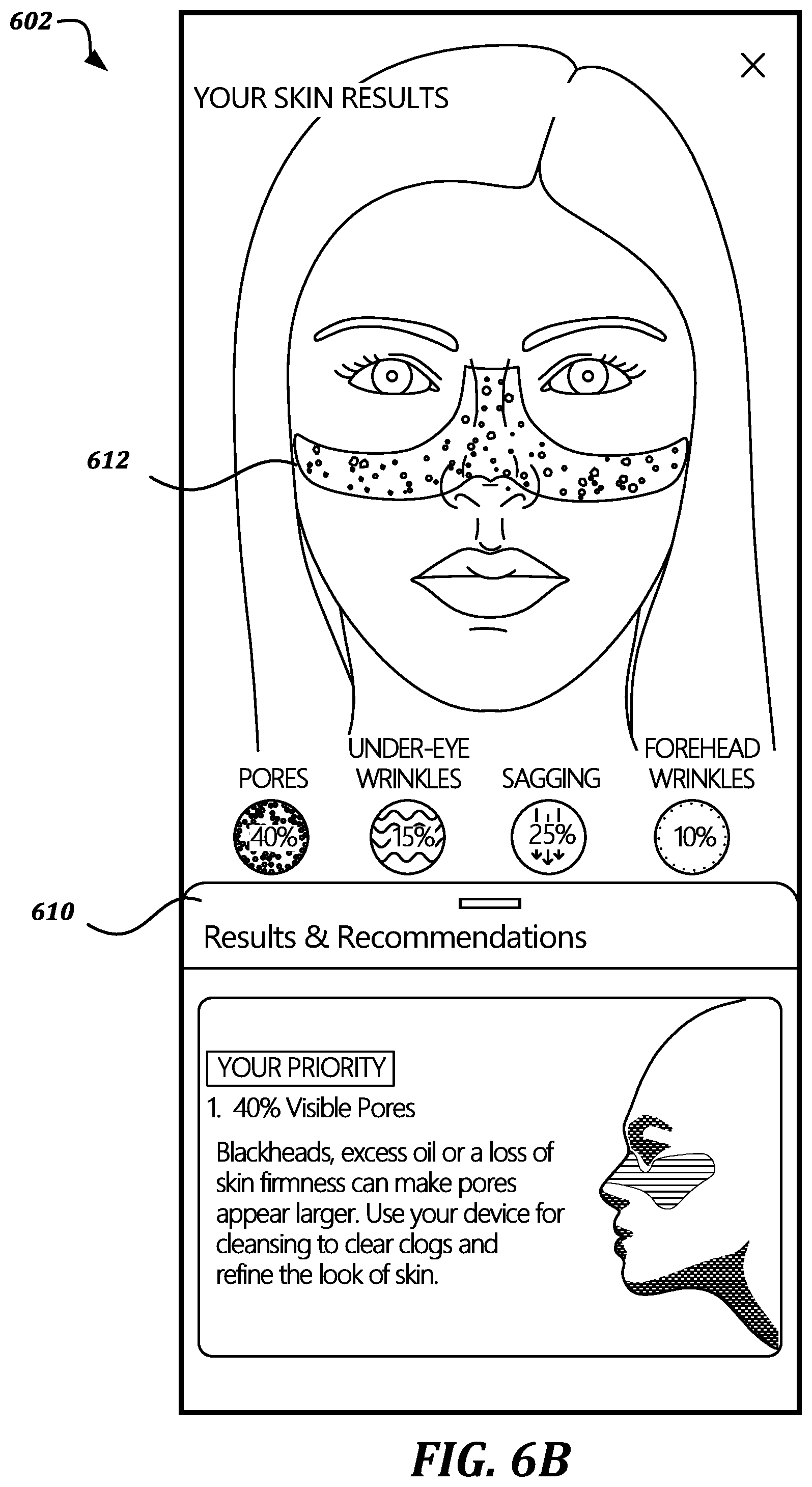 Patent US11793451 Figure 6 – Interface and analysis techniques for customized skin care regimen based on skin diagnostics