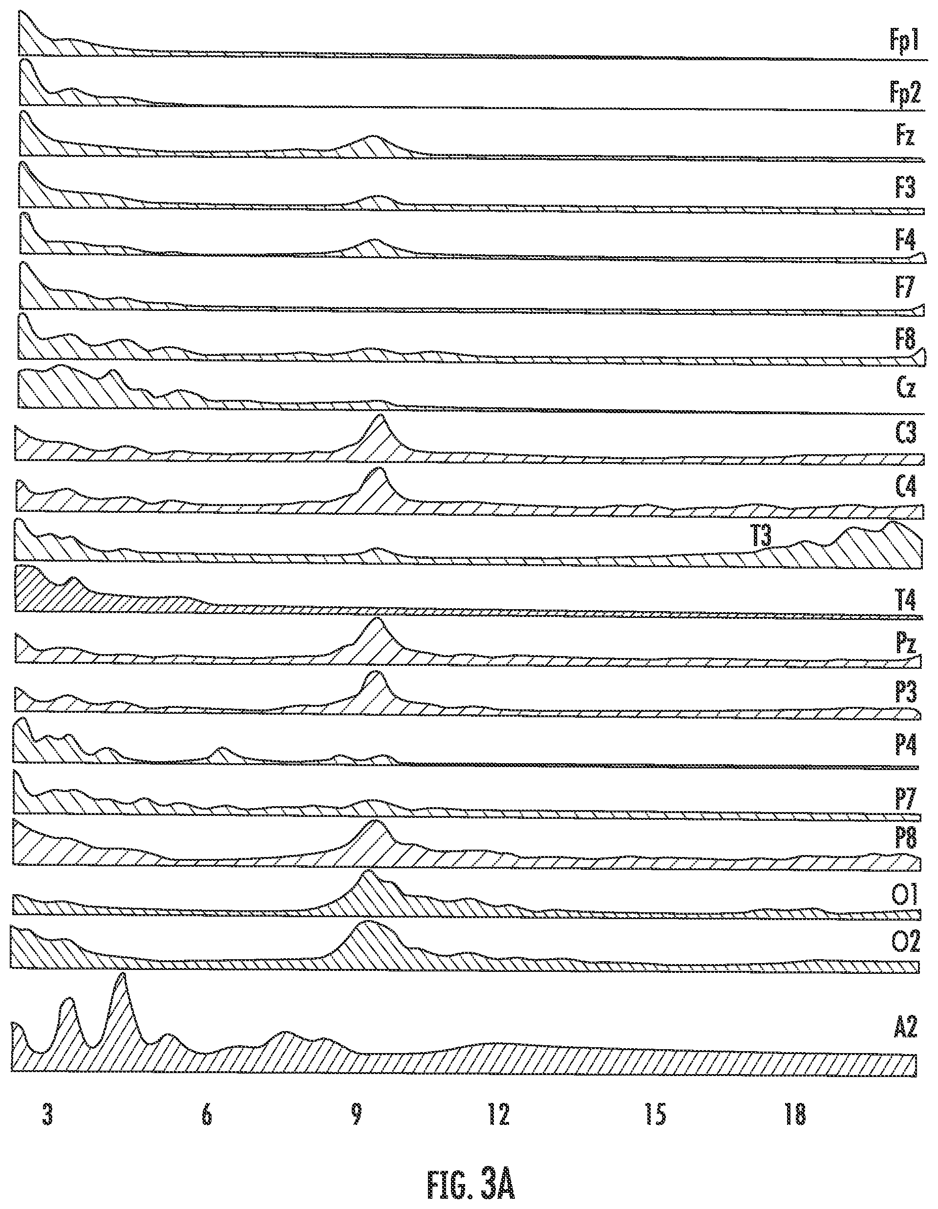 Patent US11793456 Figure 3 – Treatment using individualized transcranial magnetic stimulation