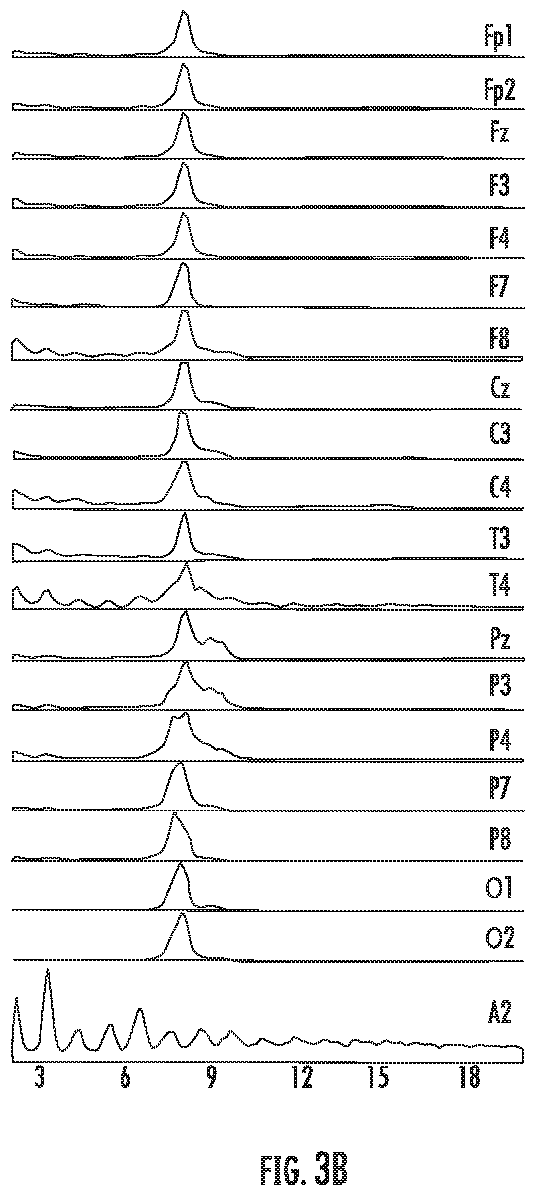 Patent US11793456 Figure 4 – Treatment using individualized transcranial magnetic stimulation