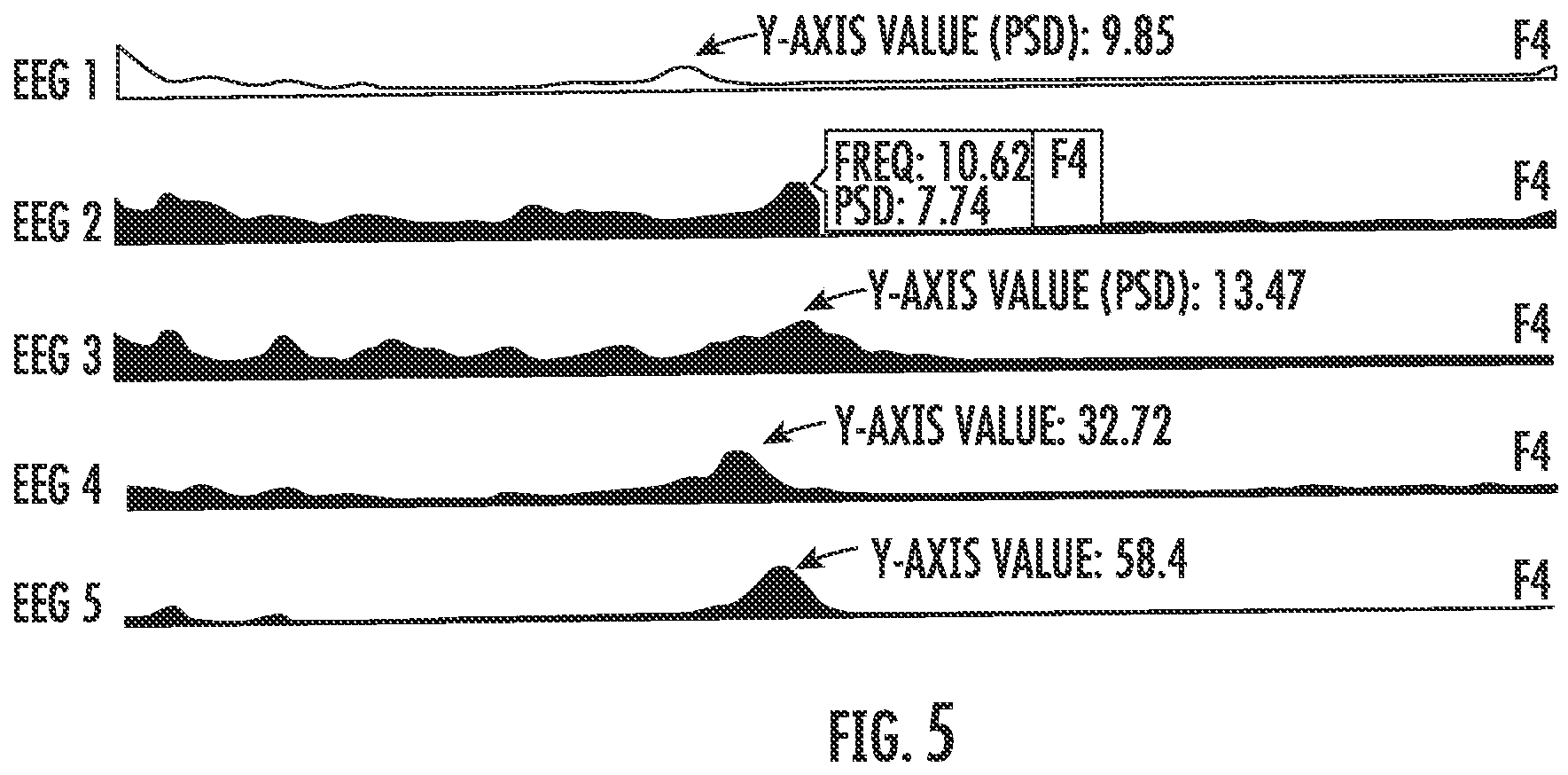 Patent US11793456 Figure 6 – Treatment using individualized transcranial magnetic stimulation