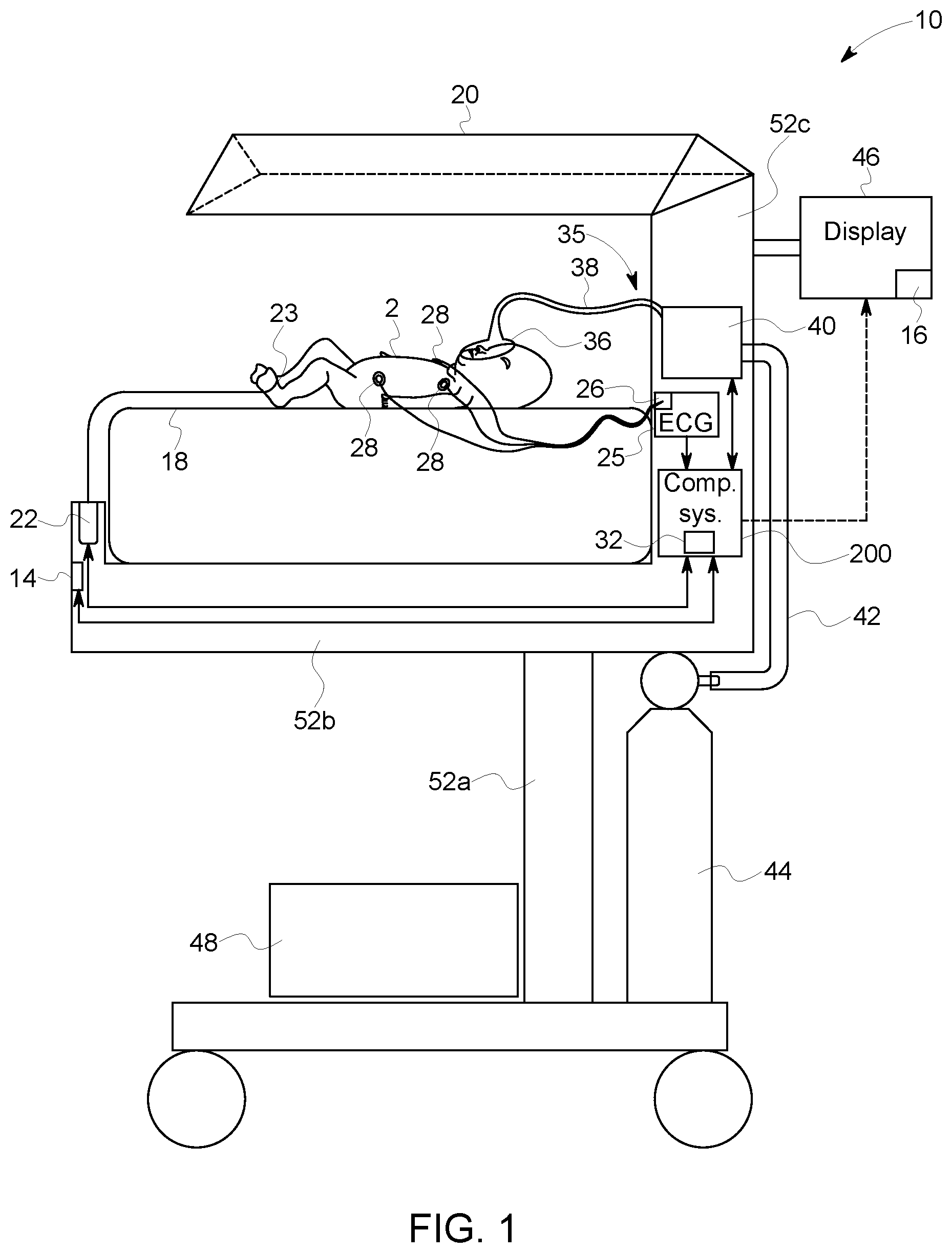 Patent US11793457 Figure 1 – Infant warming system having ECG monitor and method for providing resuscitation assistance