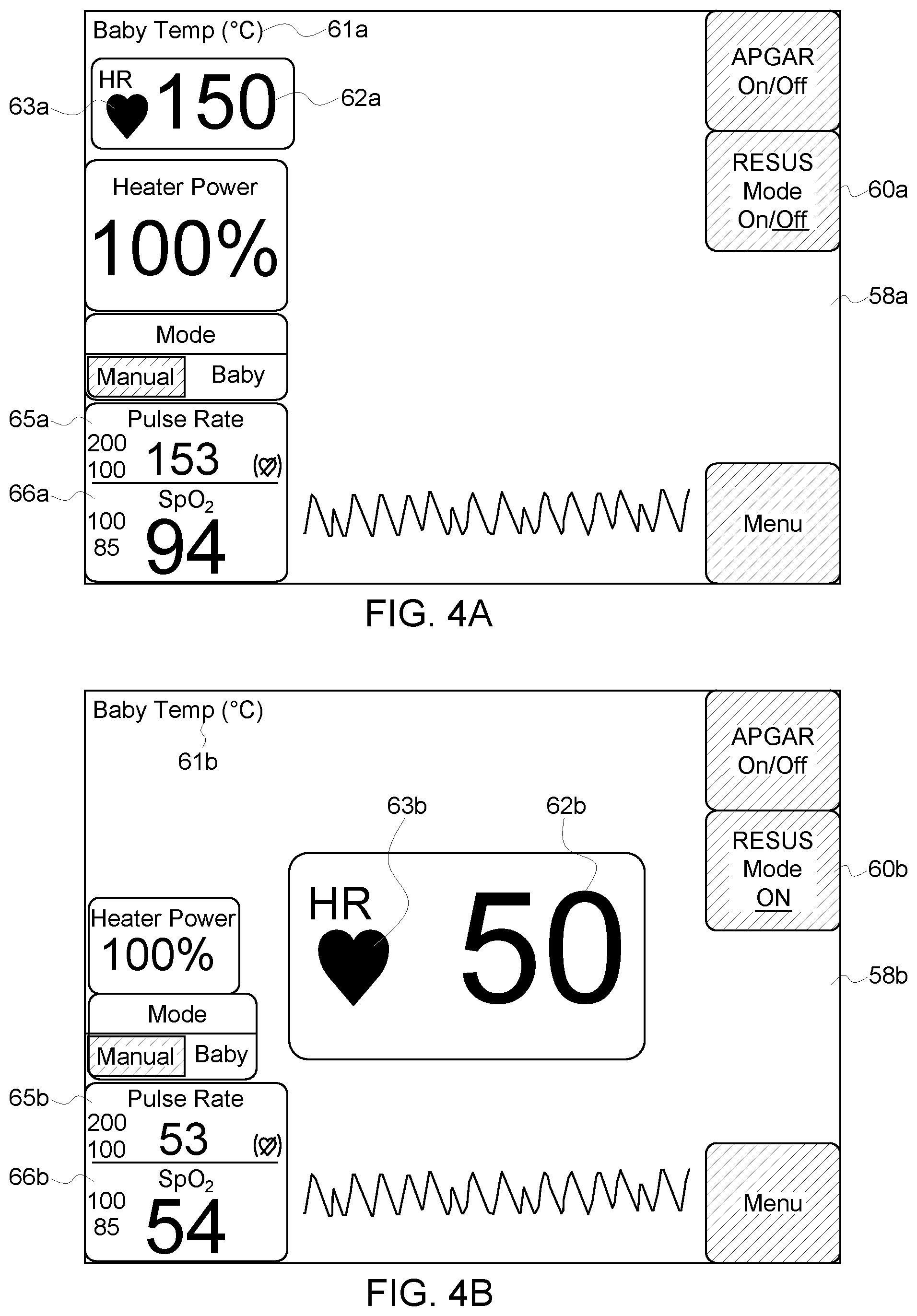 Patent US11793457 Figure 4 – Infant warming system having ECG monitor and method for providing resuscitation assistance