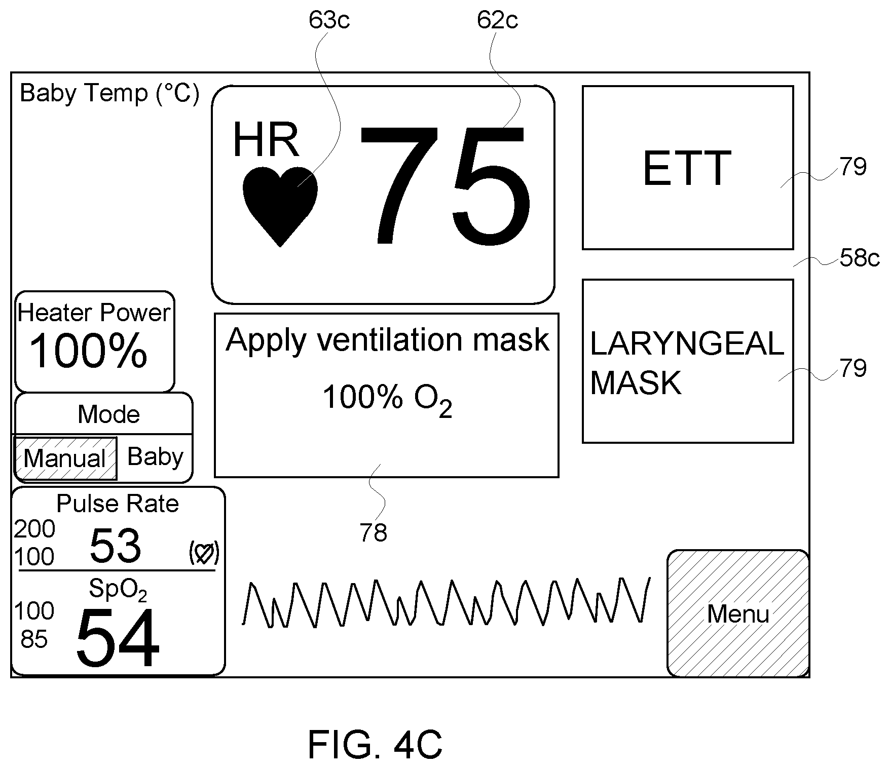 Patent US11793457 Figure 5 – Infant warming system having ECG monitor and method for providing resuscitation assistance