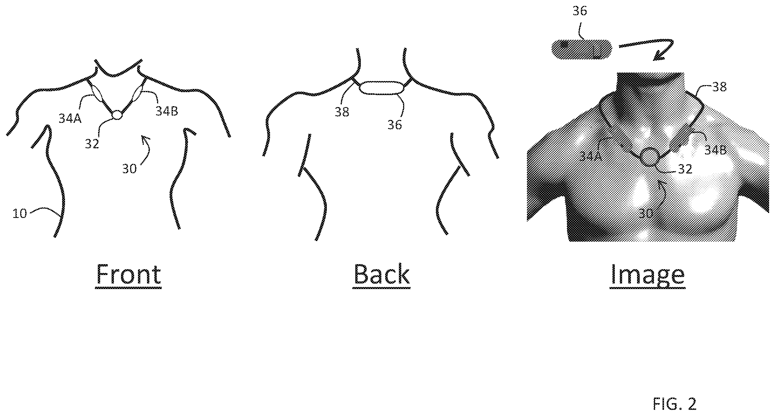 Patent US11793460 Figure 2 – Body-worn sensor for characterizing patients with heart failure