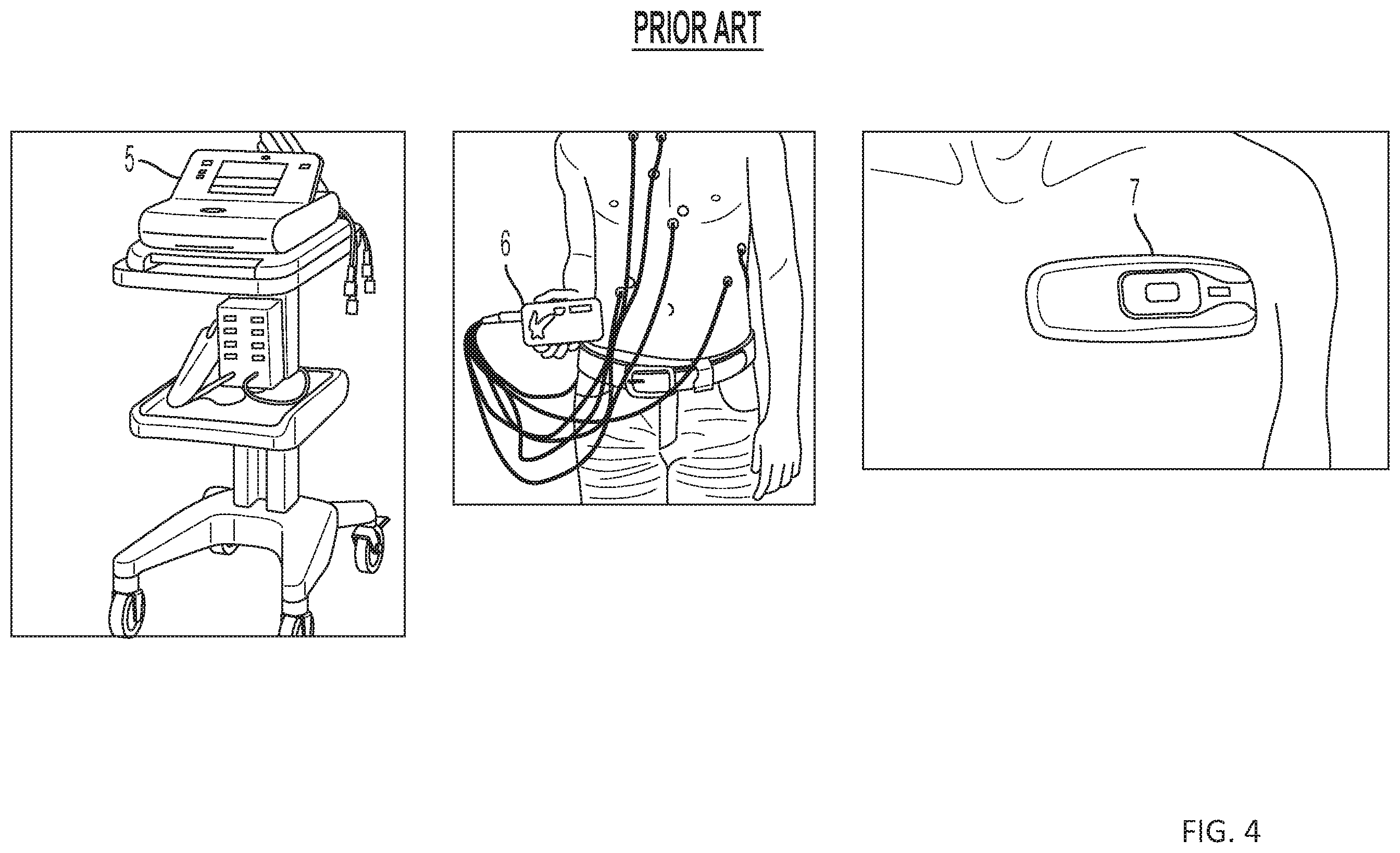 Patent US11793460 Figure 4 – Body-worn sensor for characterizing patients with heart failure