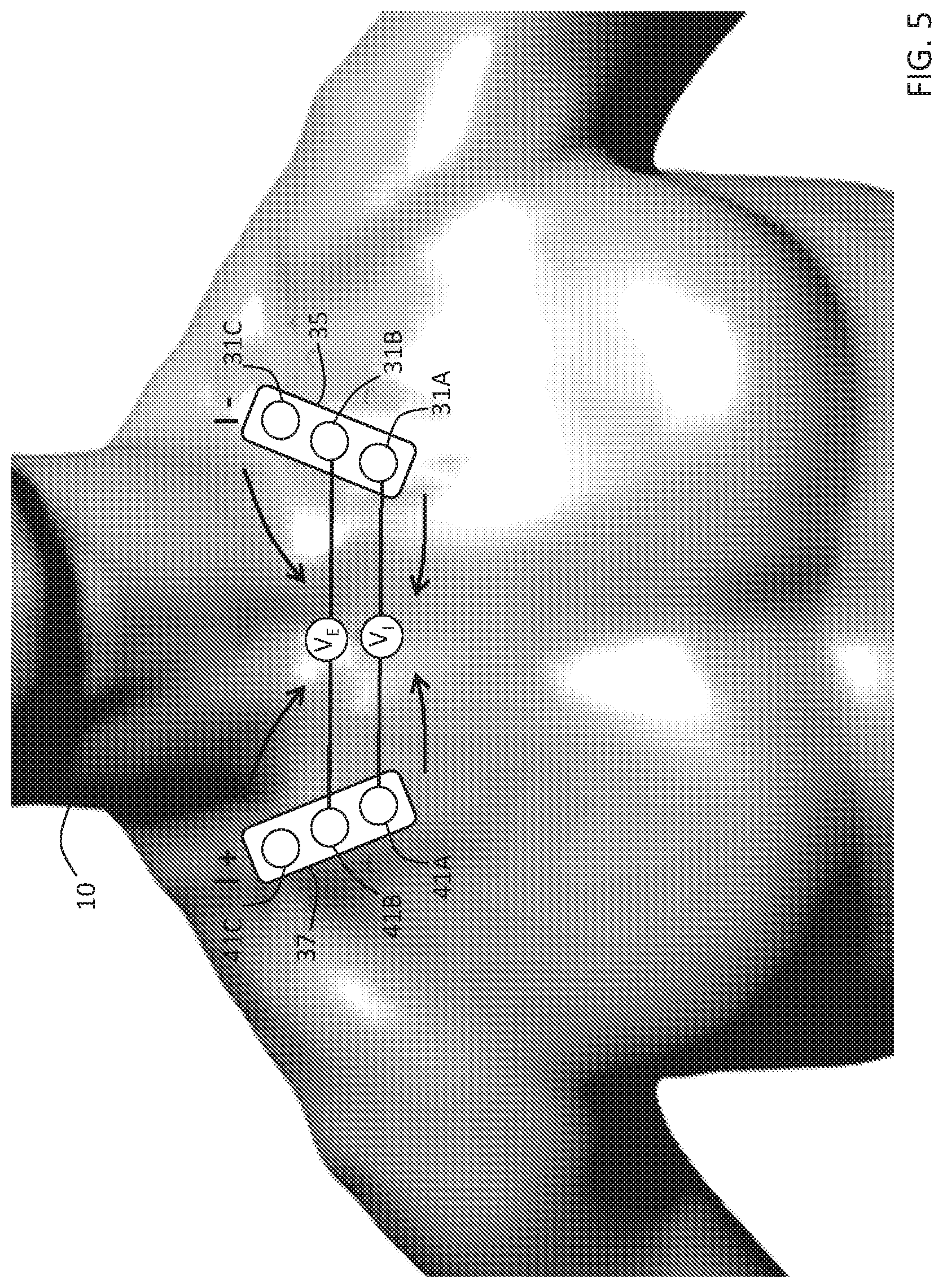 Patent US11793460 Figure 5 – Body-worn sensor for characterizing patients with heart failure
