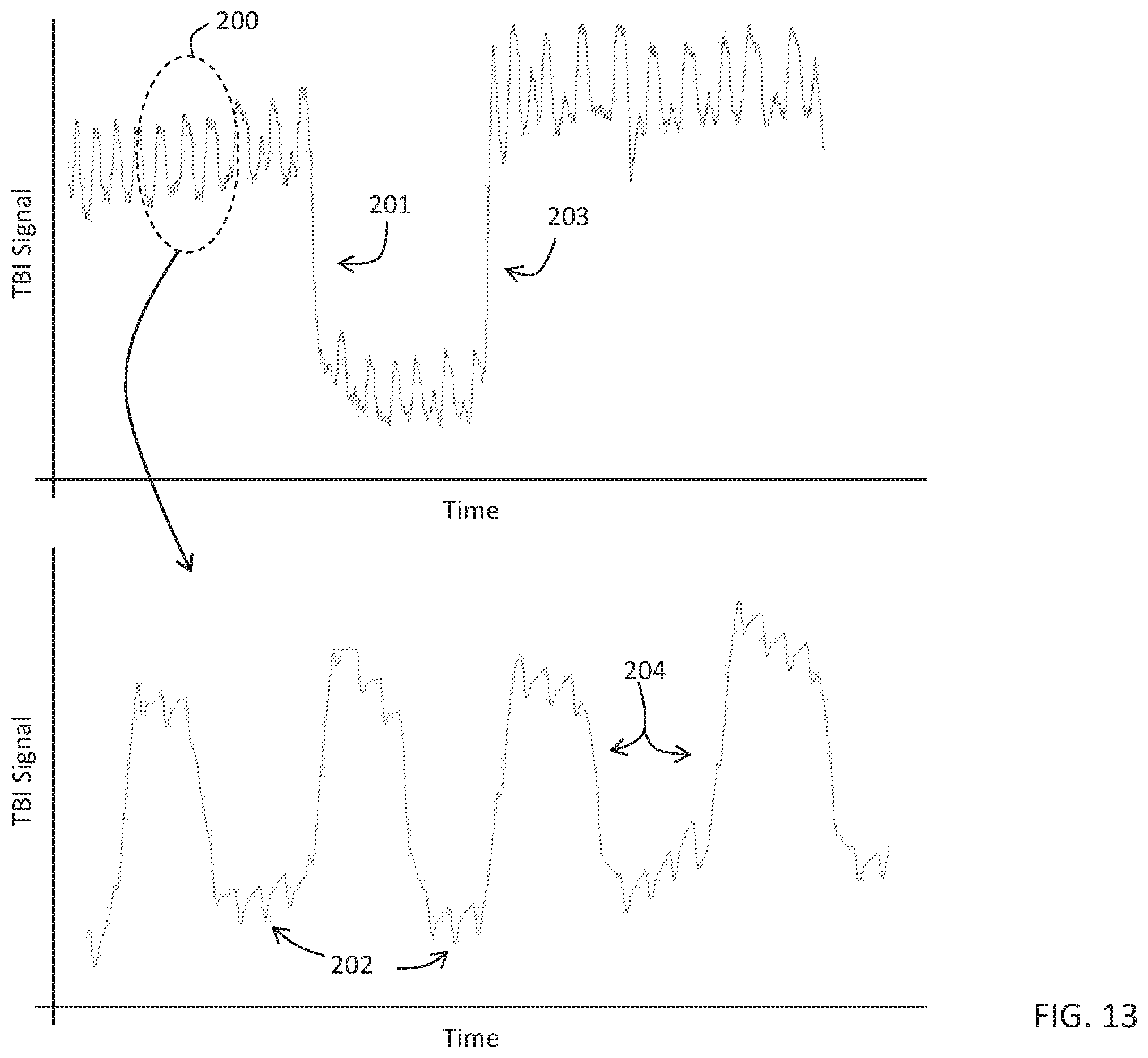 Patent US11793460 Figure 13 – Body-worn sensor for characterizing patients with heart failure
