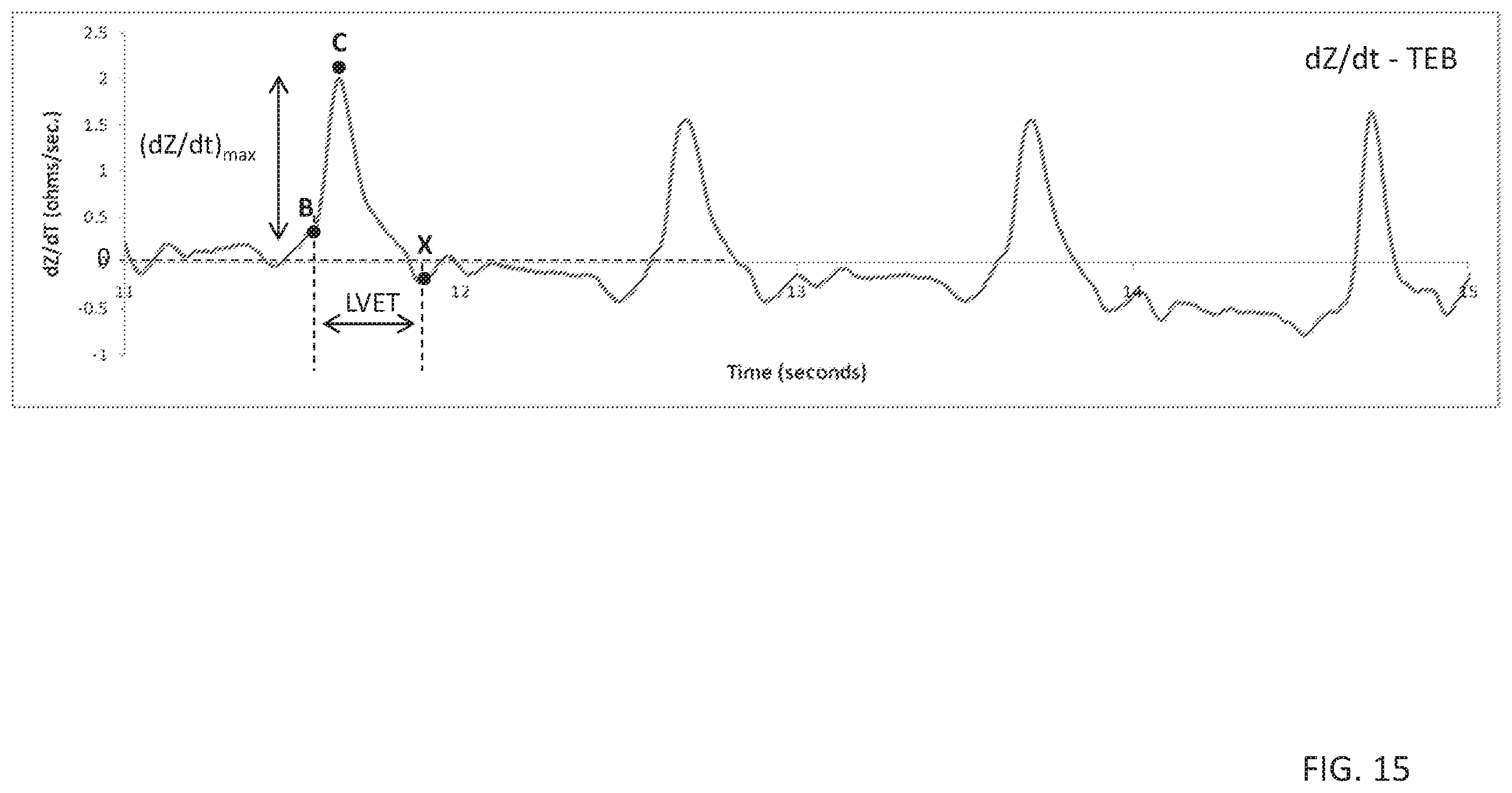 Patent US11793460 Figure 15 – Body-worn sensor for characterizing patients with heart failure