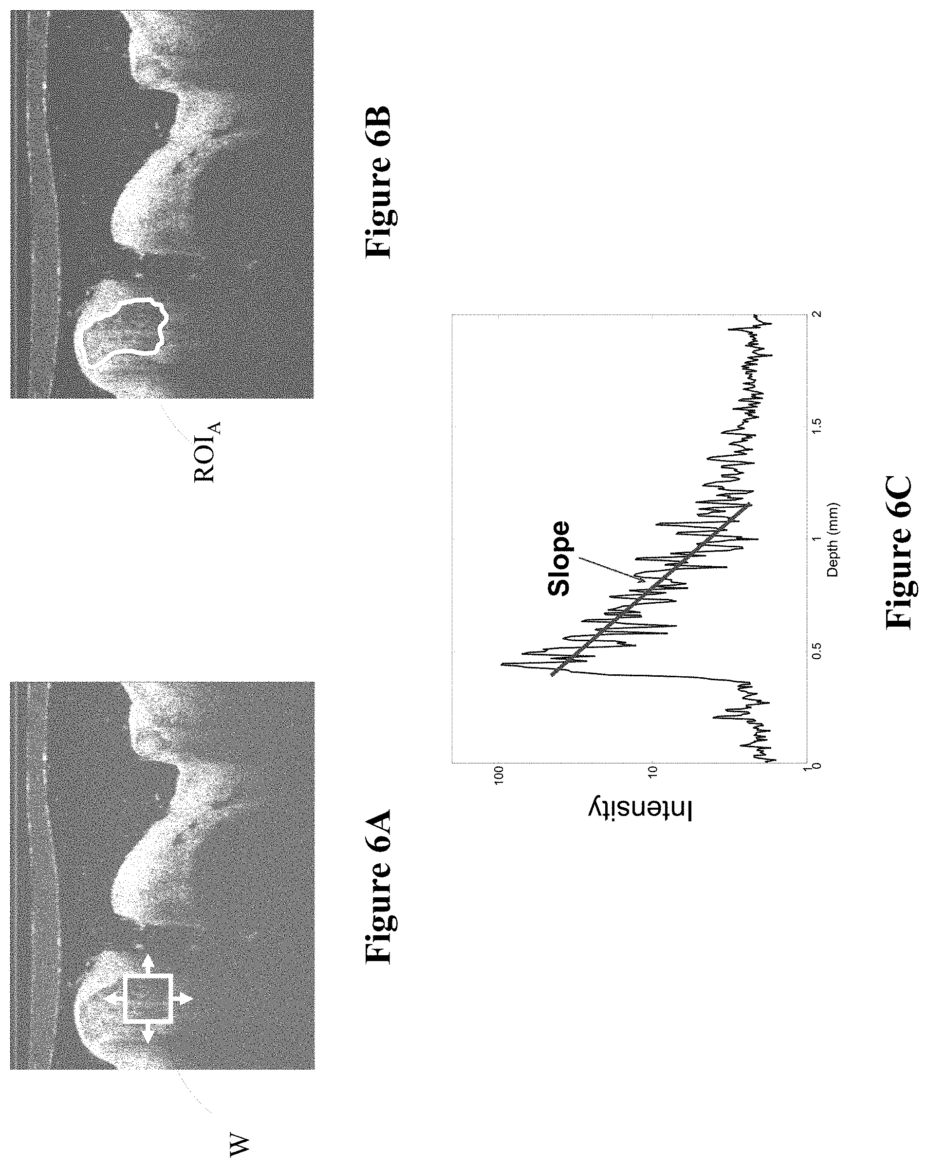 Patent US11793462 Figure 7 – Intravascular measurement and data collection systems, apparatus and methods