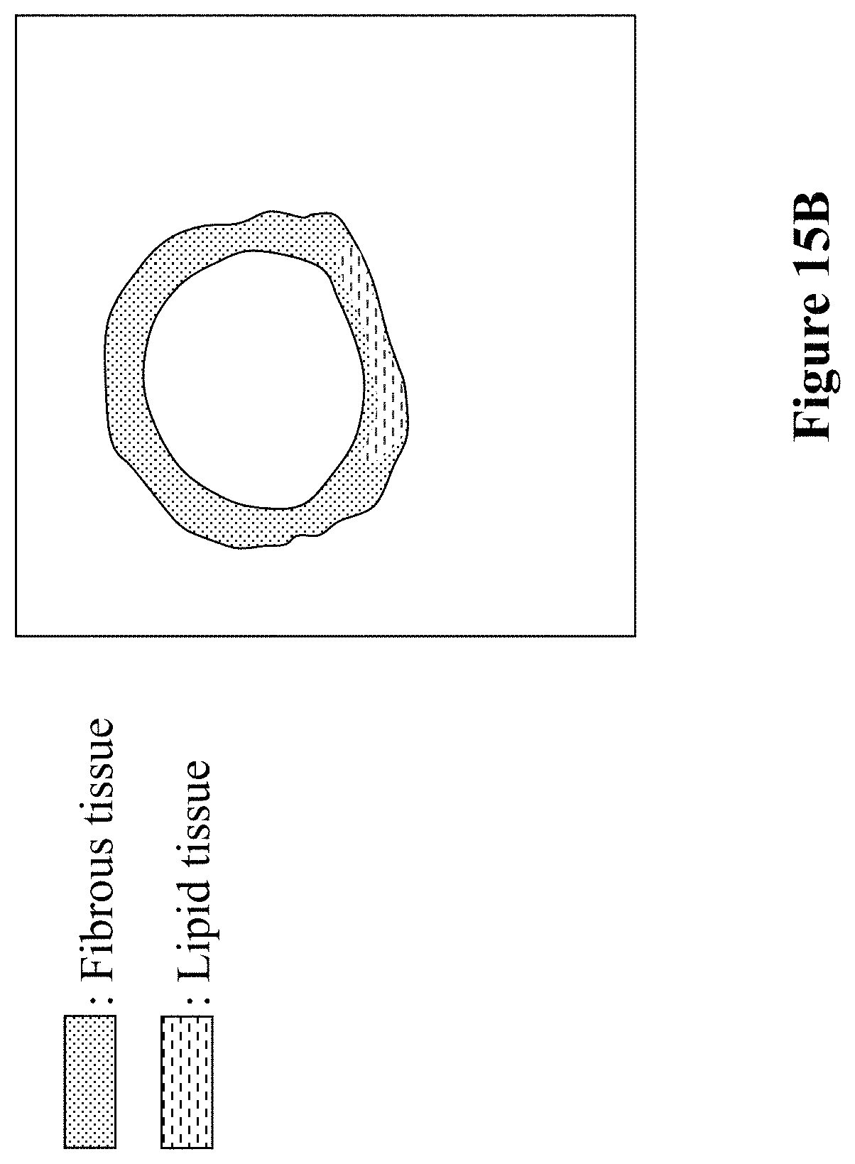 Patent US11793462 Figure 20 – Intravascular measurement and data collection systems, apparatus and methods