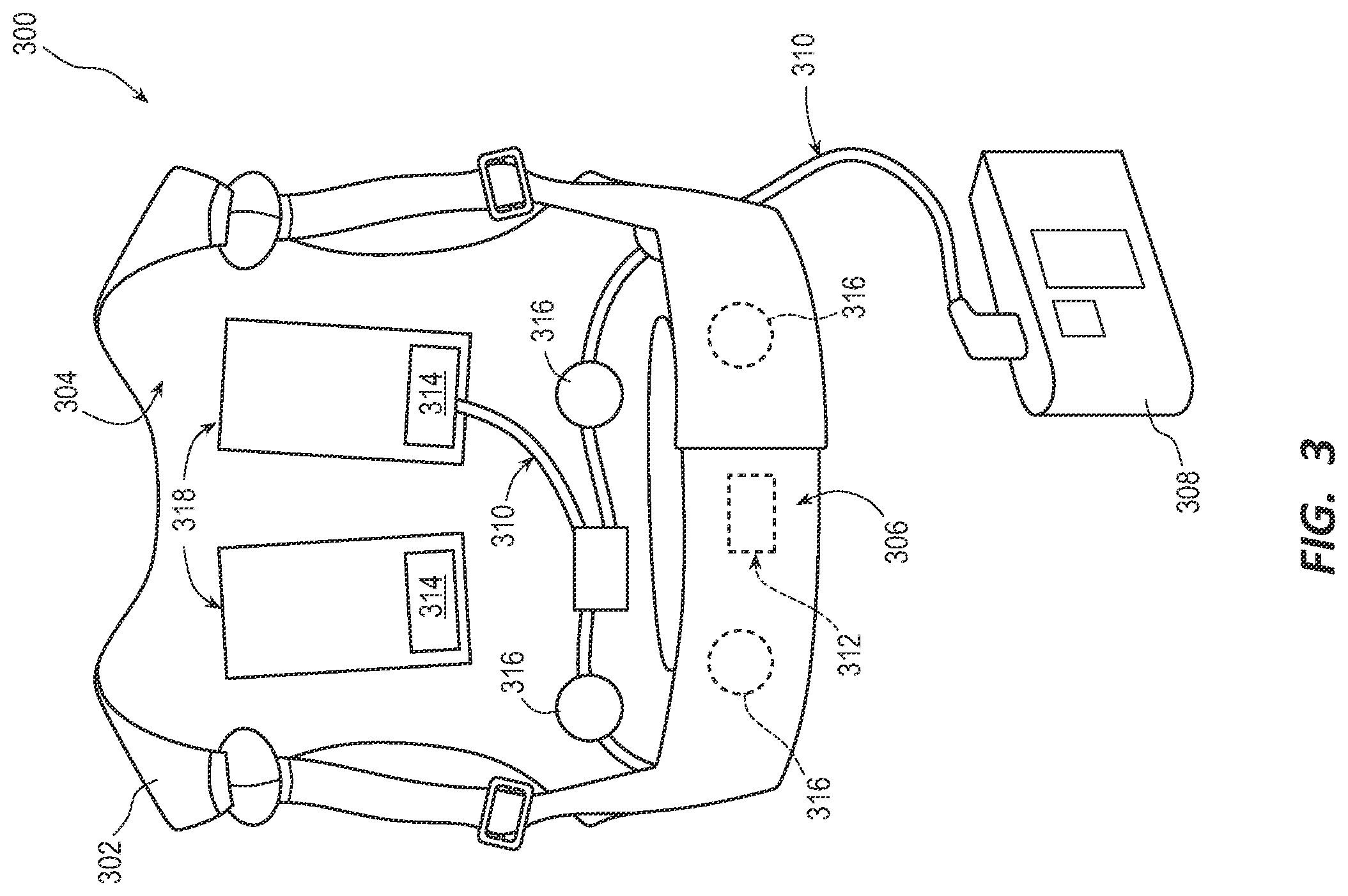 Patent US11793469 Figure 3 – Identifying reliable vectors