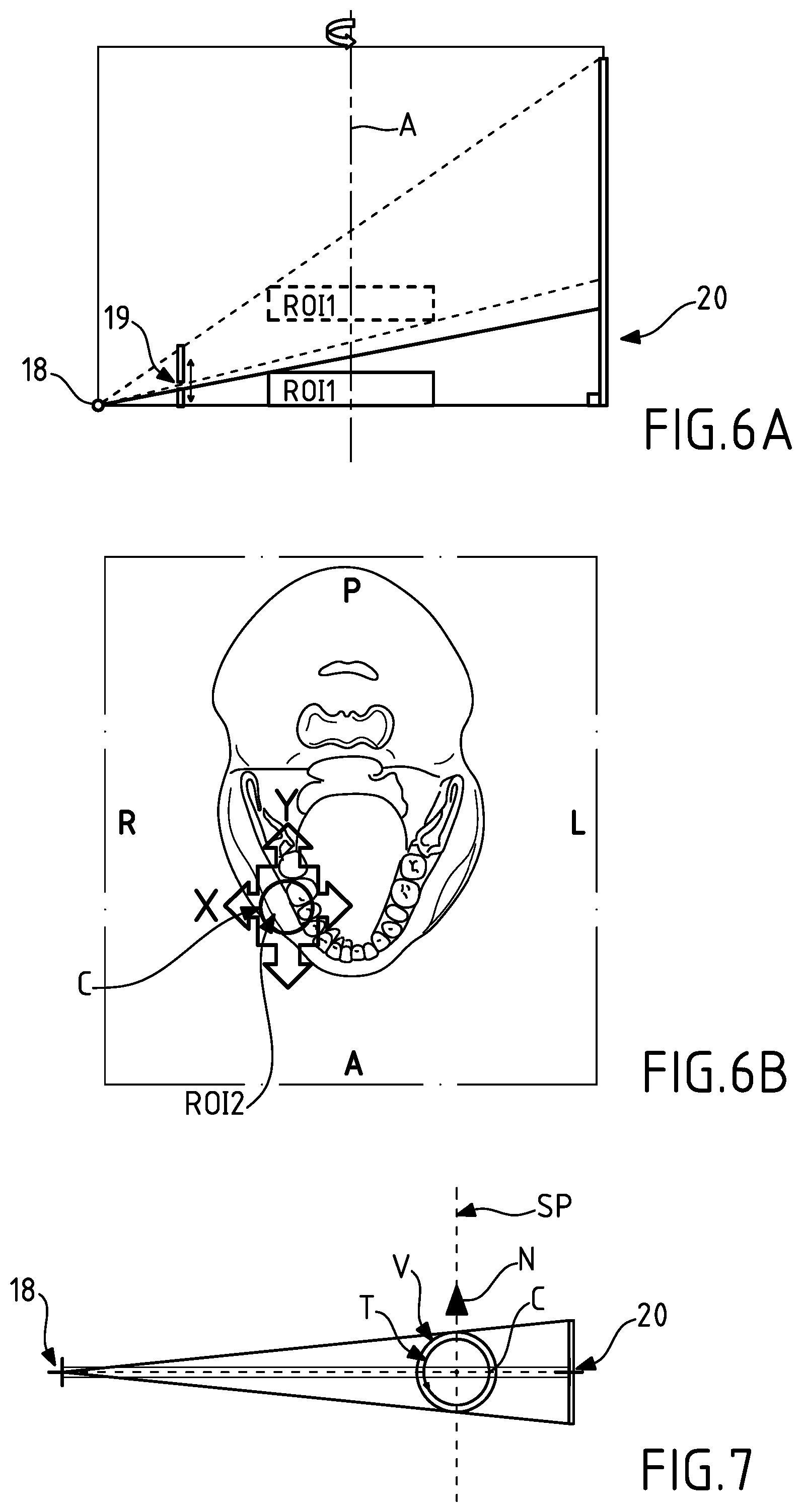 Patent US11793475 Figure 4 – Method and system for obtaining operating parameters for 3D x ray acquisition
