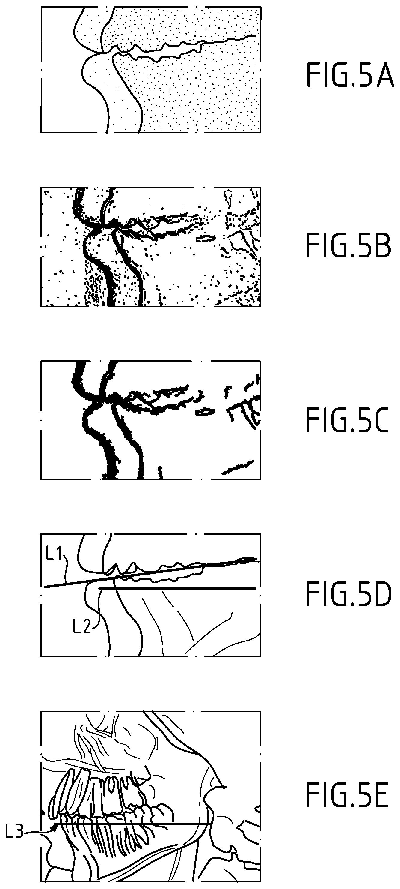 Patent US11793476 Figure 4 – Method and a system for obtaining operating parameters for x ray data acquisition