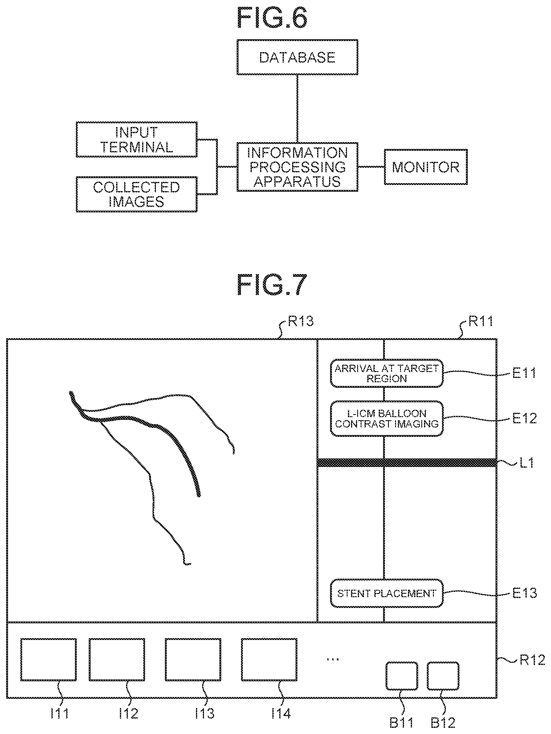 Patent US11793477 Figure 7 – Medical information processing apparatus, x-ray diagnostic apparatus, and medical information processing program
