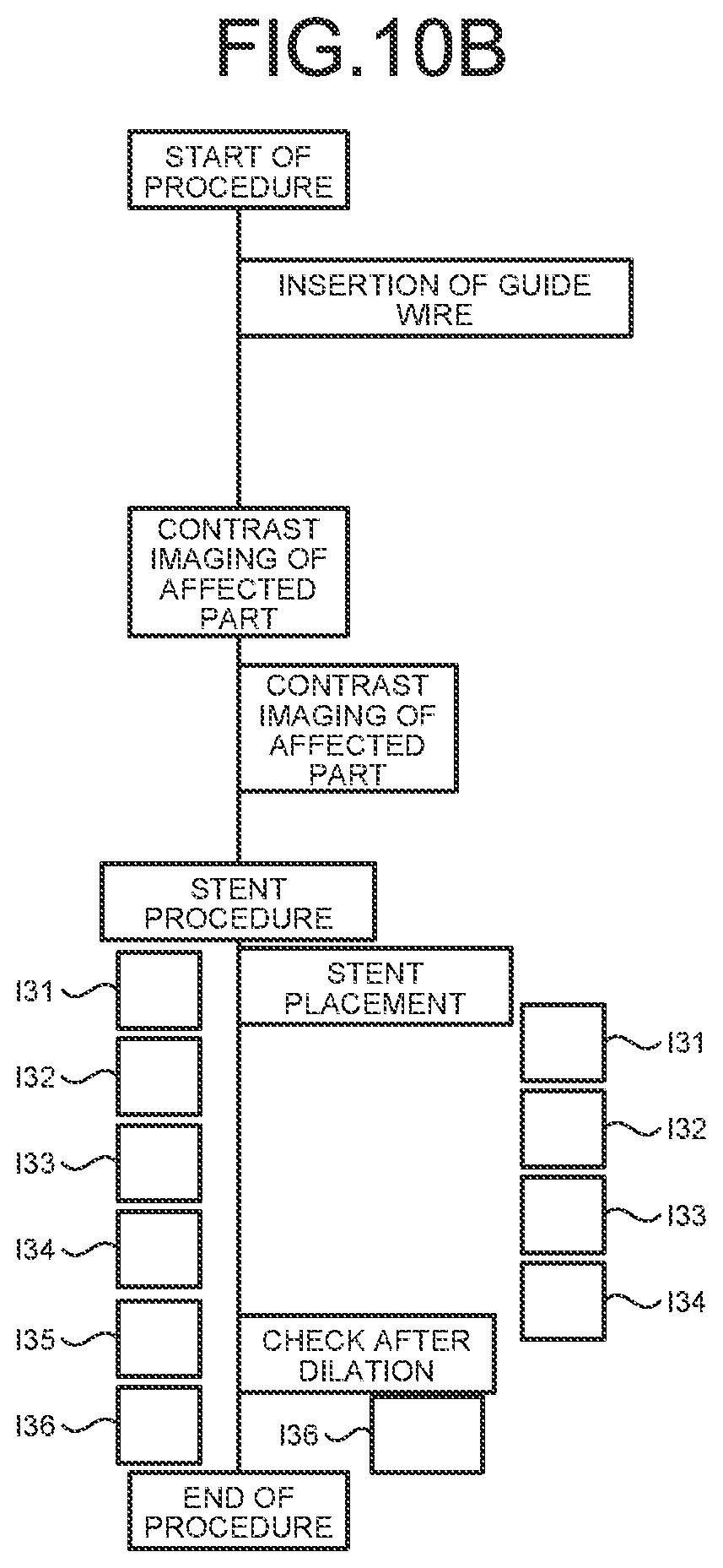 Patent US11793477 Figure 11 – Medical information processing apparatus, x-ray diagnostic apparatus, and medical information processing program
