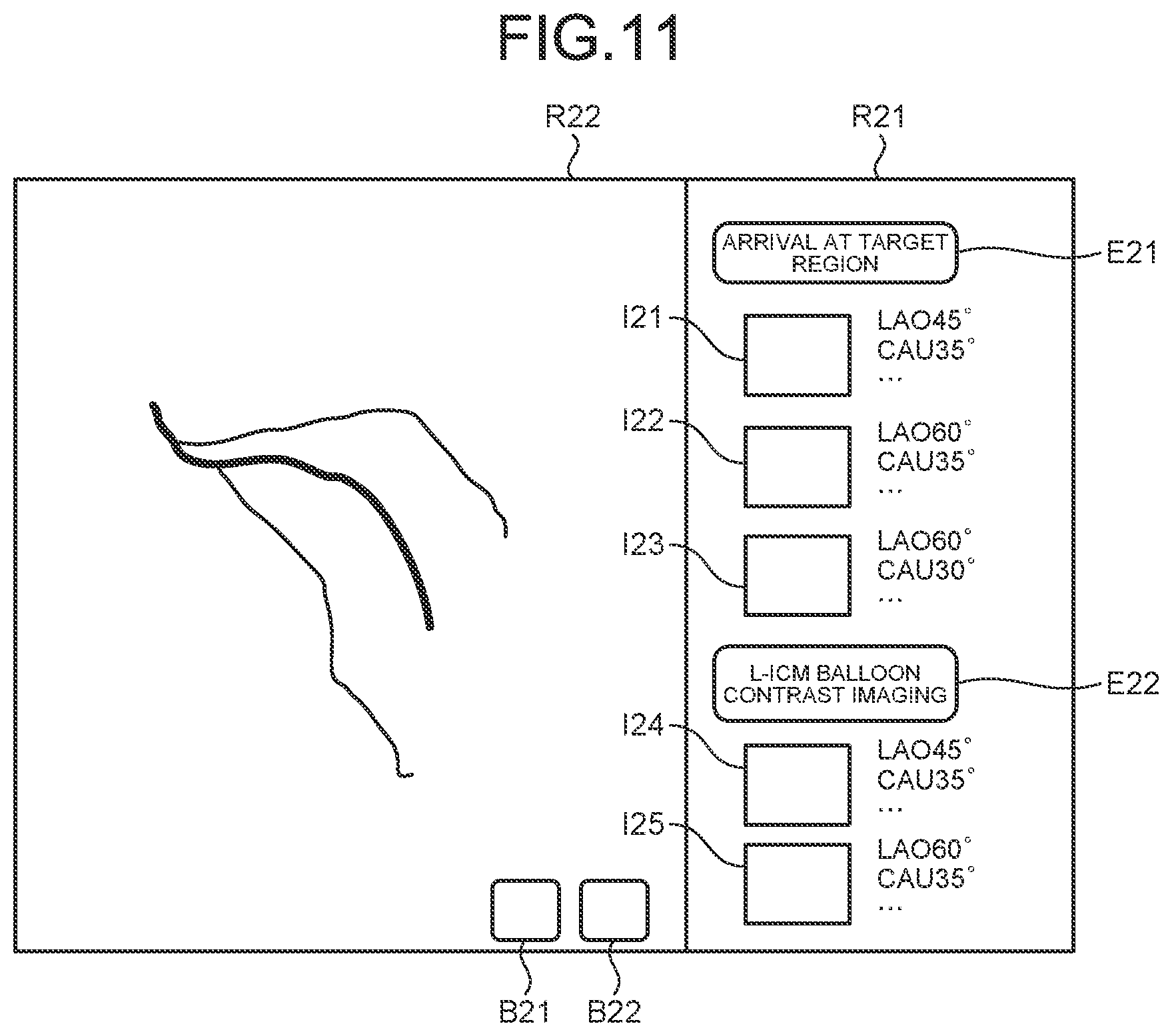 Patent US11793477 Figure 12 – Medical information processing apparatus, x-ray diagnostic apparatus, and medical information processing program