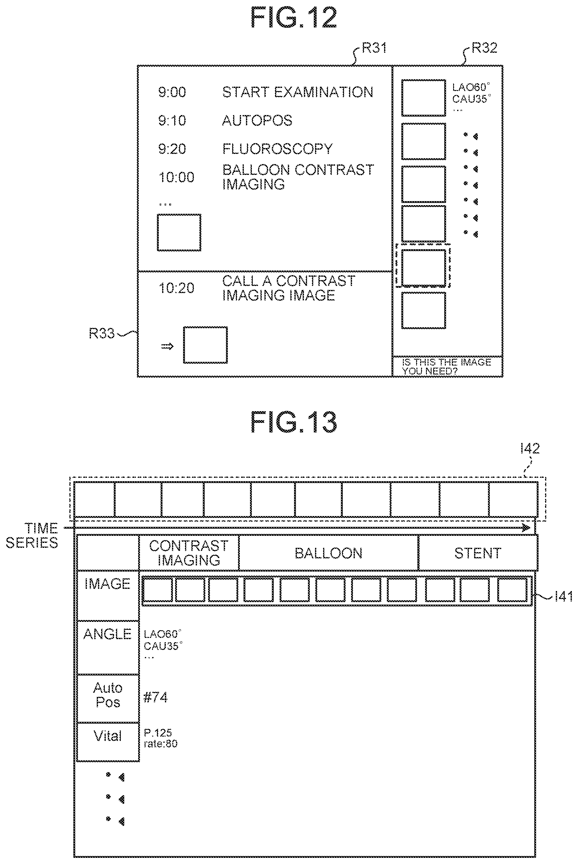 Patent US11793477 Figure 13 – Medical information processing apparatus, x-ray diagnostic apparatus, and medical information processing program