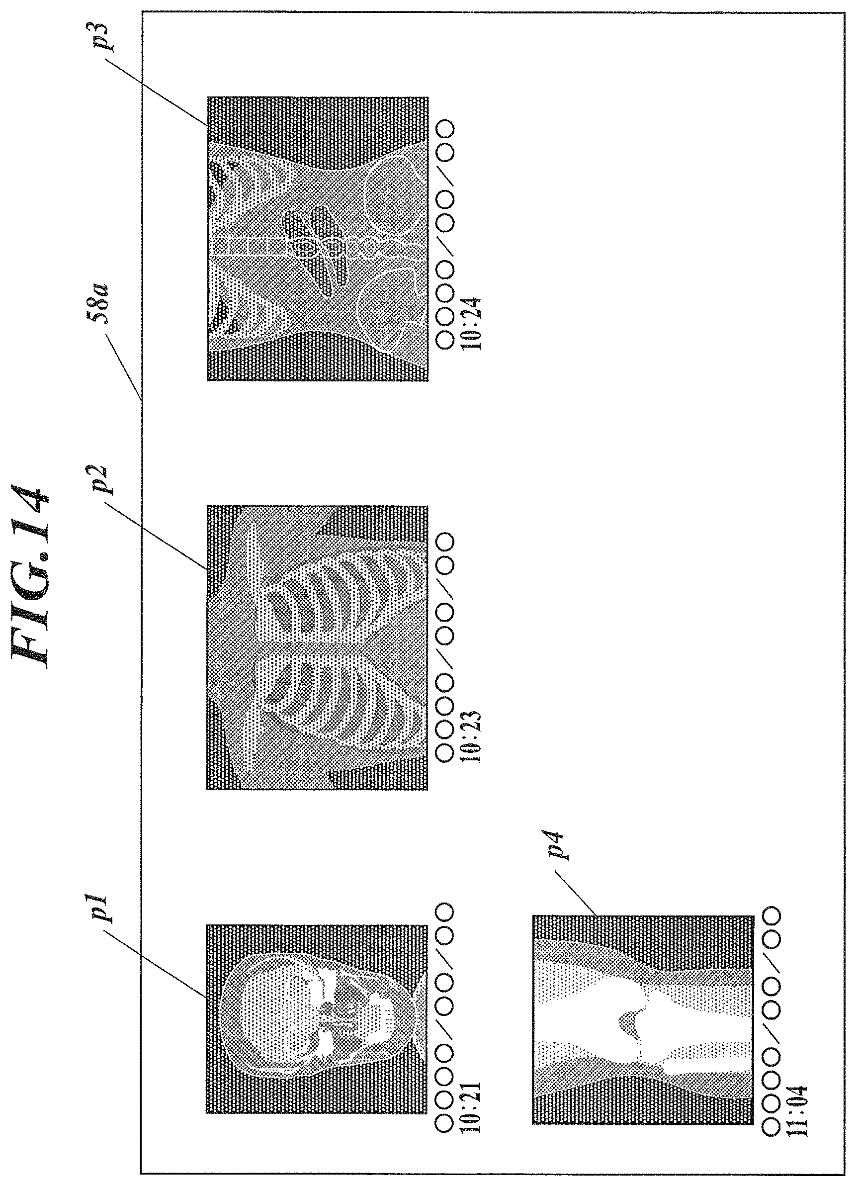 Patent US11793479 Figure 11 – Radiography apparatus and radiography system