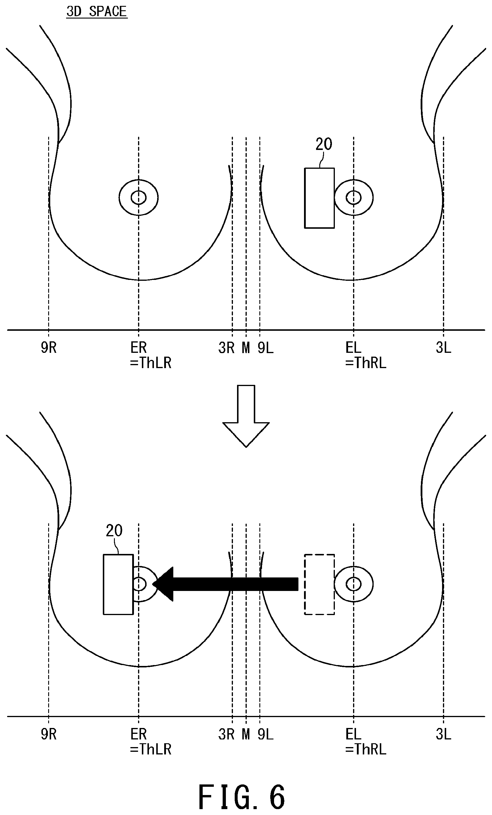 Patent US11793481 Figure 5 – Ultrasonic diagnostic apparatus and body mark display method