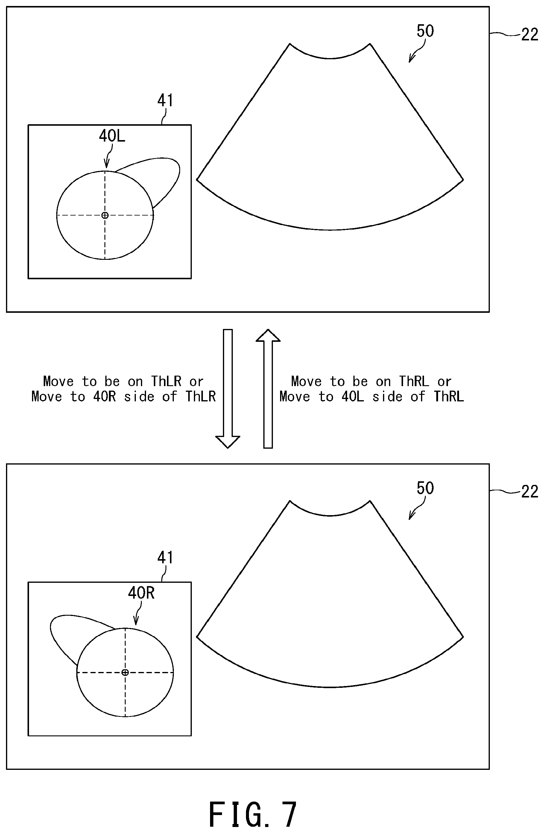 Patent US11793481 Figure 6 – Ultrasonic diagnostic apparatus and body mark display method