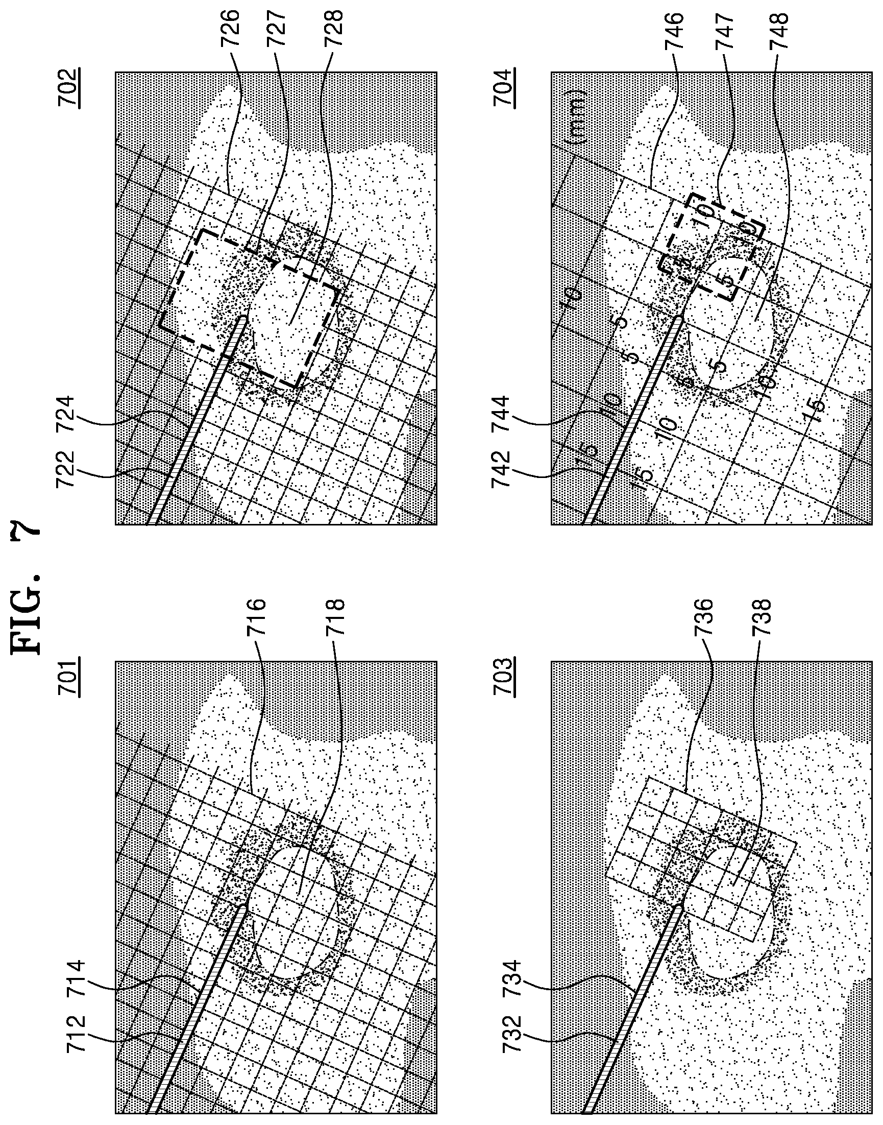 Patent US11793482 Figure 9 – Ultrasound imaging apparatus, method of controlling the same, and computer program product