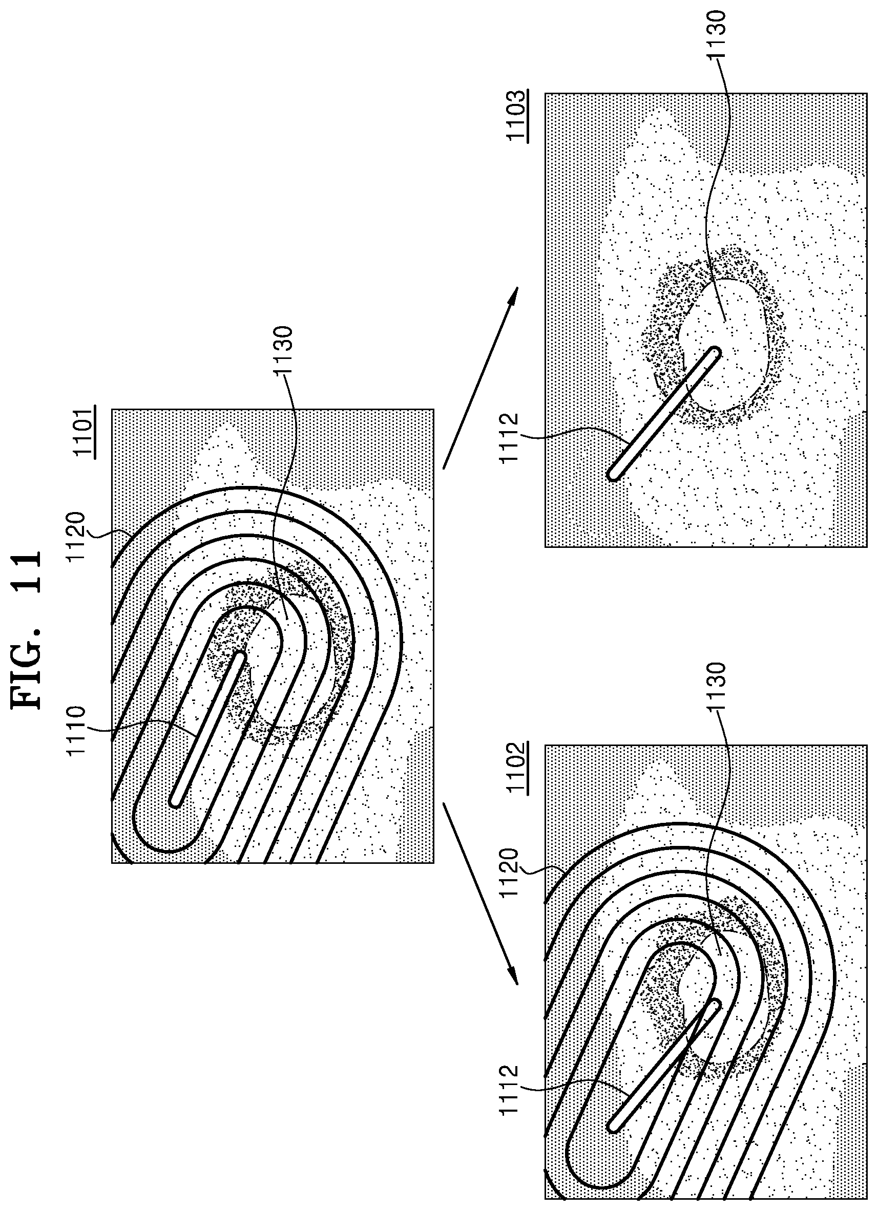 Patent US11793482 Figure 14 – Ultrasound imaging apparatus, method of controlling the same, and computer program product