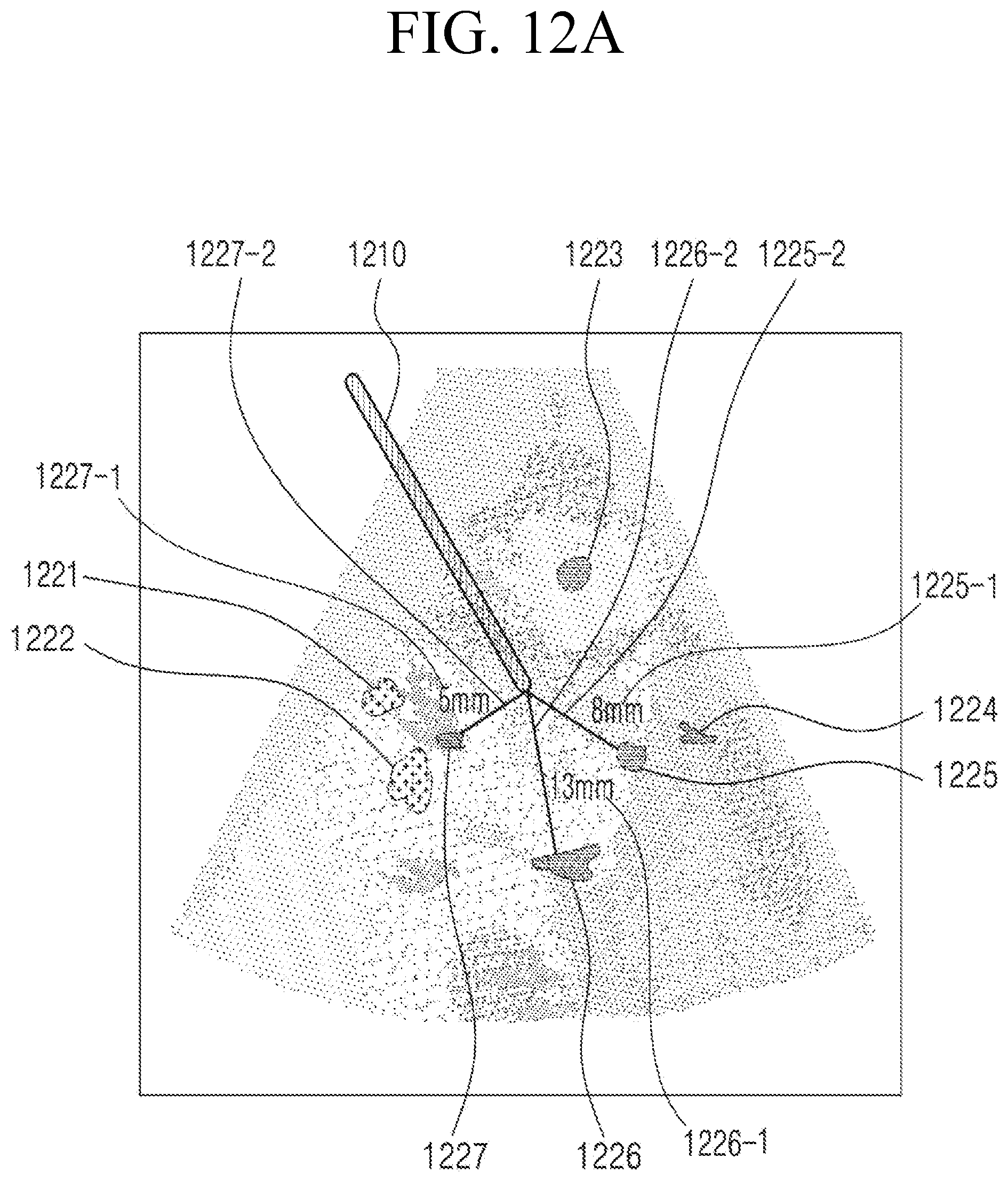 Patent US11793482 Figure 15 – Ultrasound imaging apparatus, method of controlling the same, and computer program product