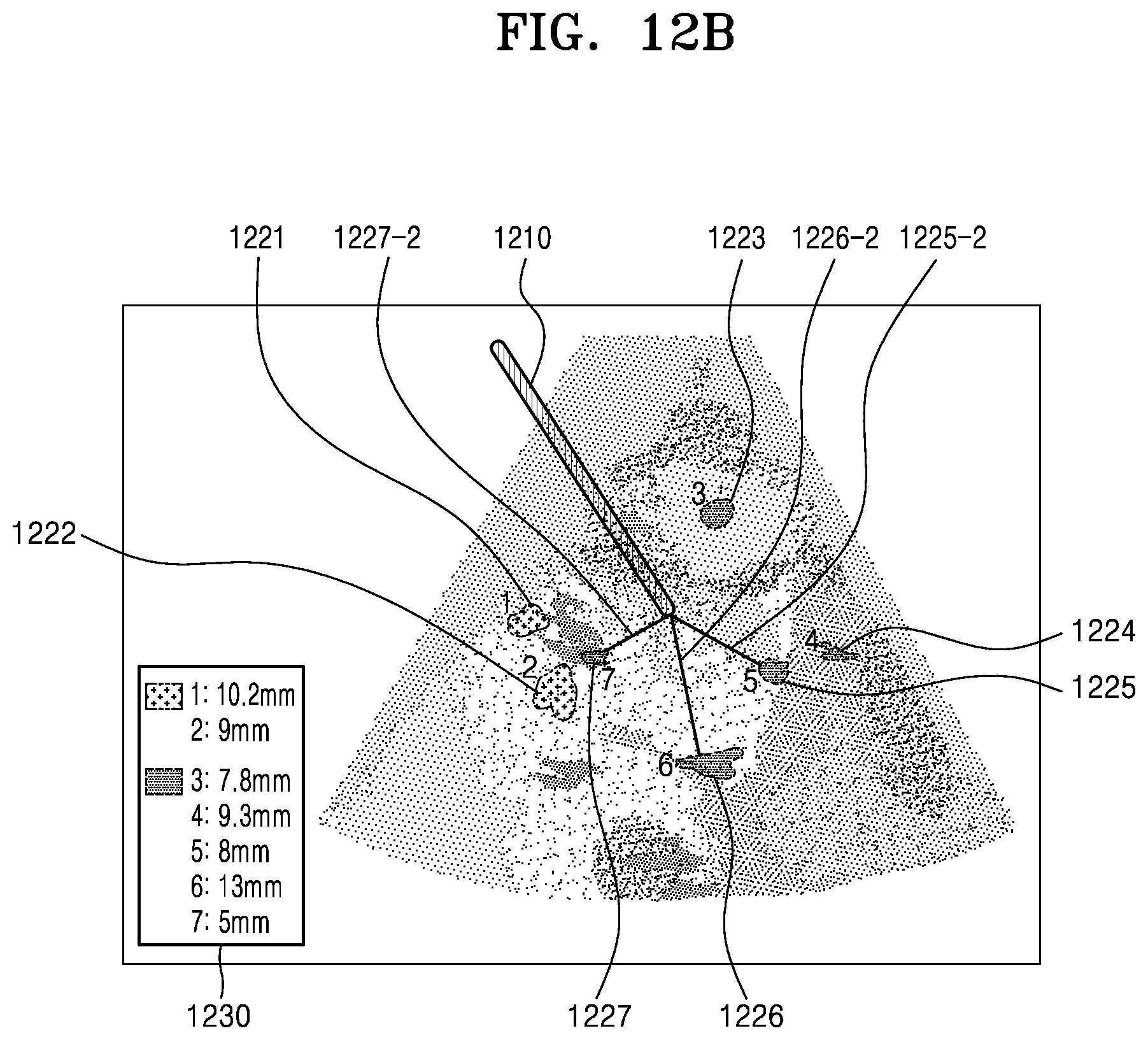 Patent US11793482 Figure 16 – Ultrasound imaging apparatus, method of controlling the same, and computer program product