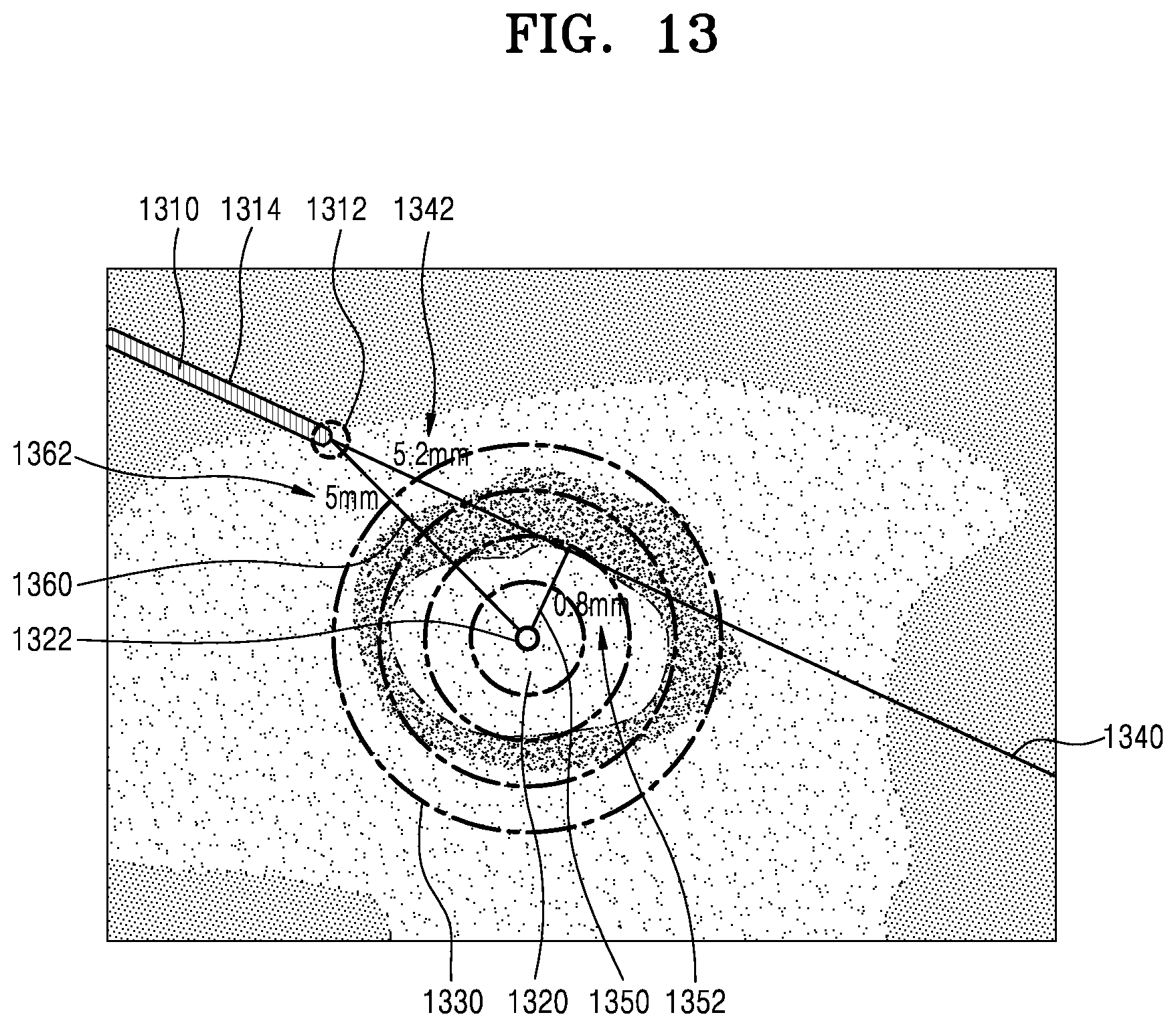 Patent US11793482 Figure 17 – Ultrasound imaging apparatus, method of controlling the same, and computer program product