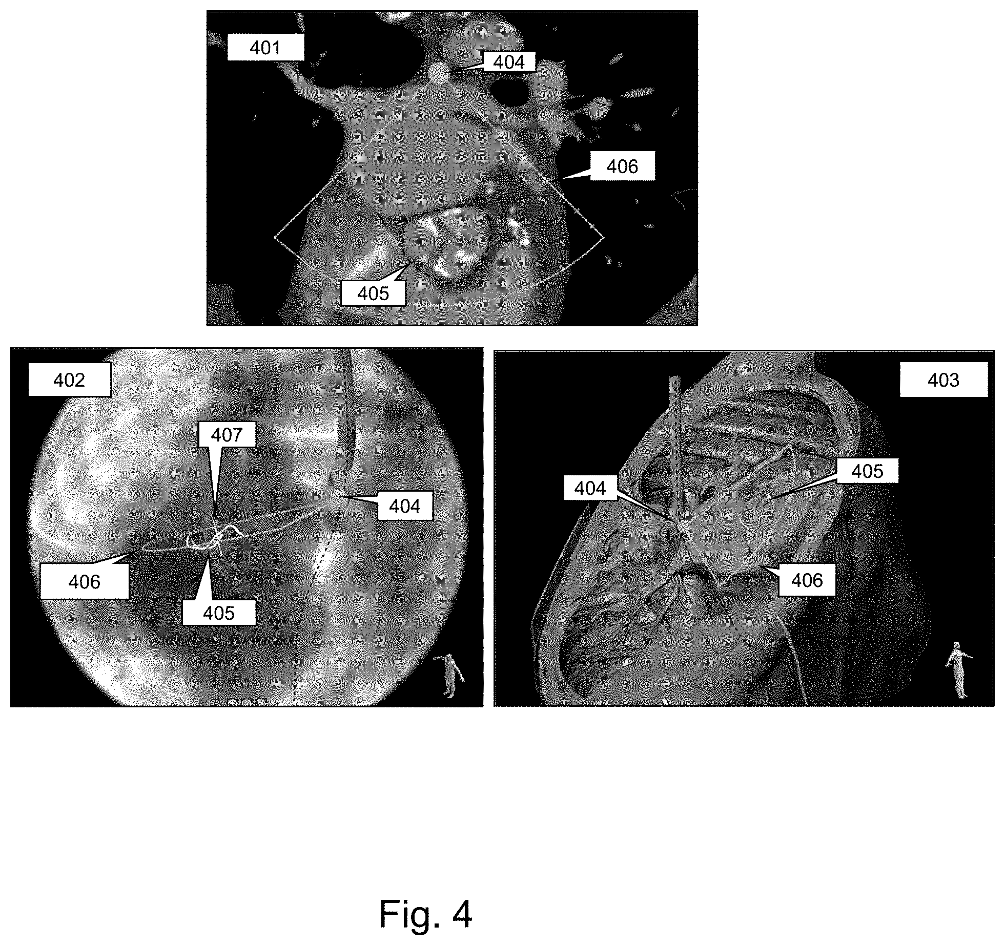 Patent US11793484 Figure 4 – Method, device and system for intracavity probe procedure planning
