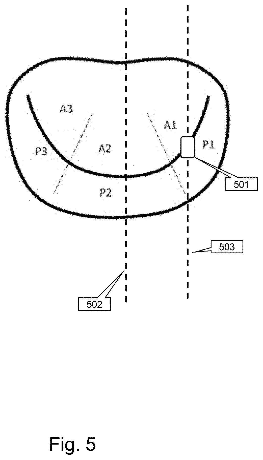 Patent US11793484 Figure 5 – Method, device and system for intracavity probe procedure planning