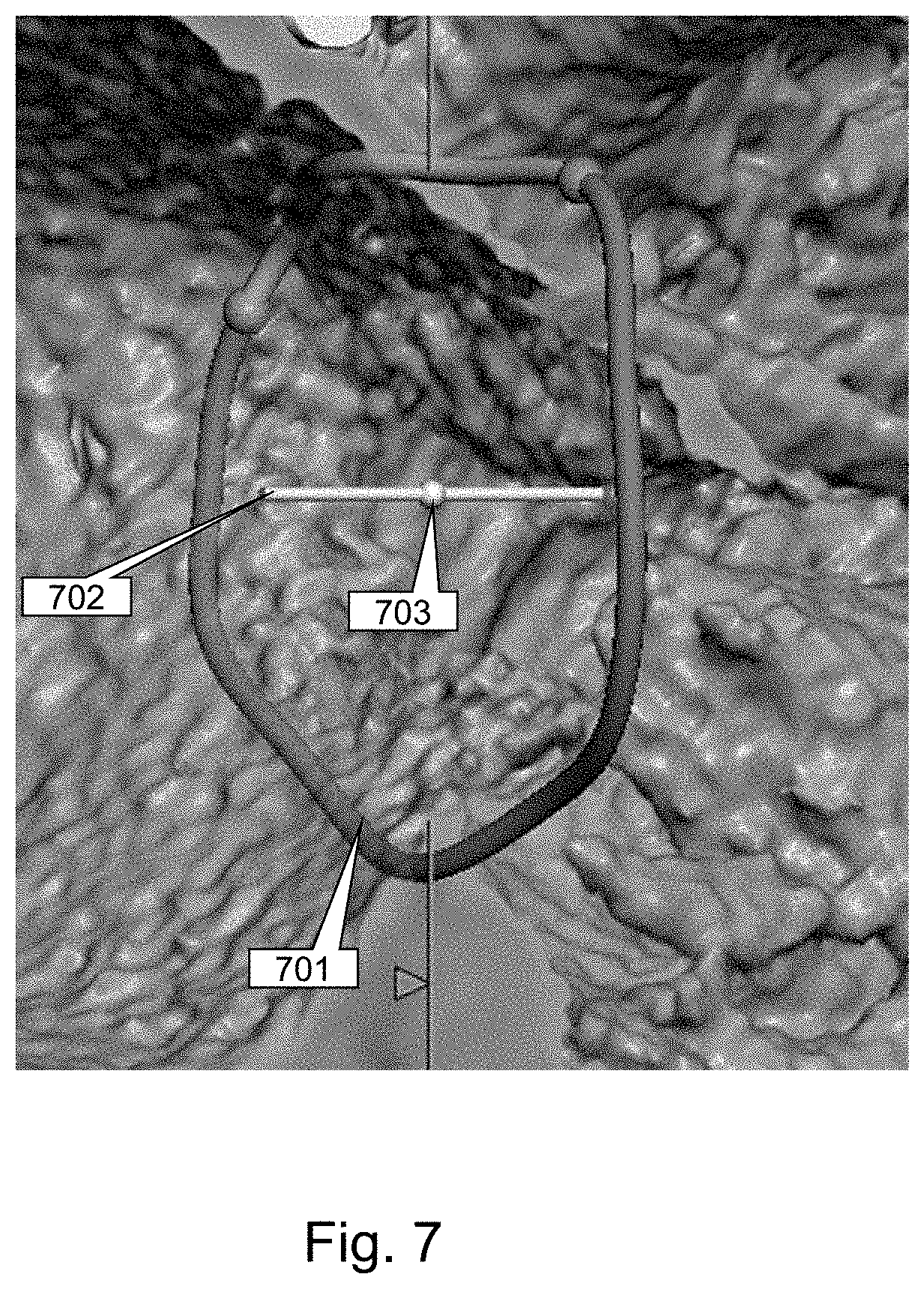 Patent US11793484 Figure 7 – Method, device and system for intracavity probe procedure planning