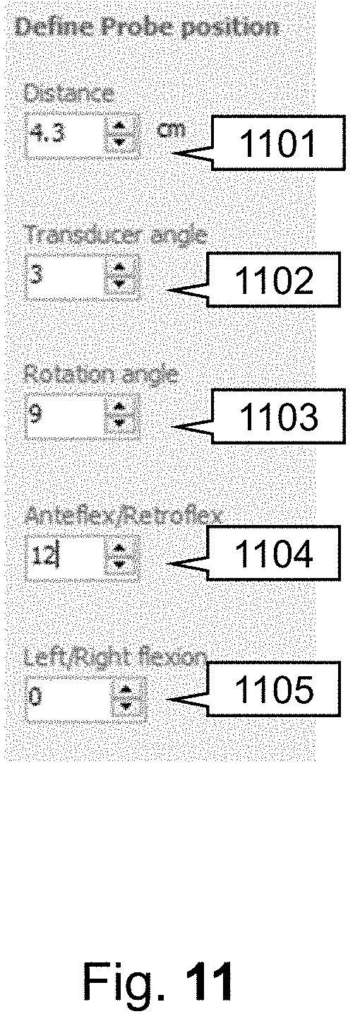 Patent US11793484 Figure 11 – Method, device and system for intracavity probe procedure planning