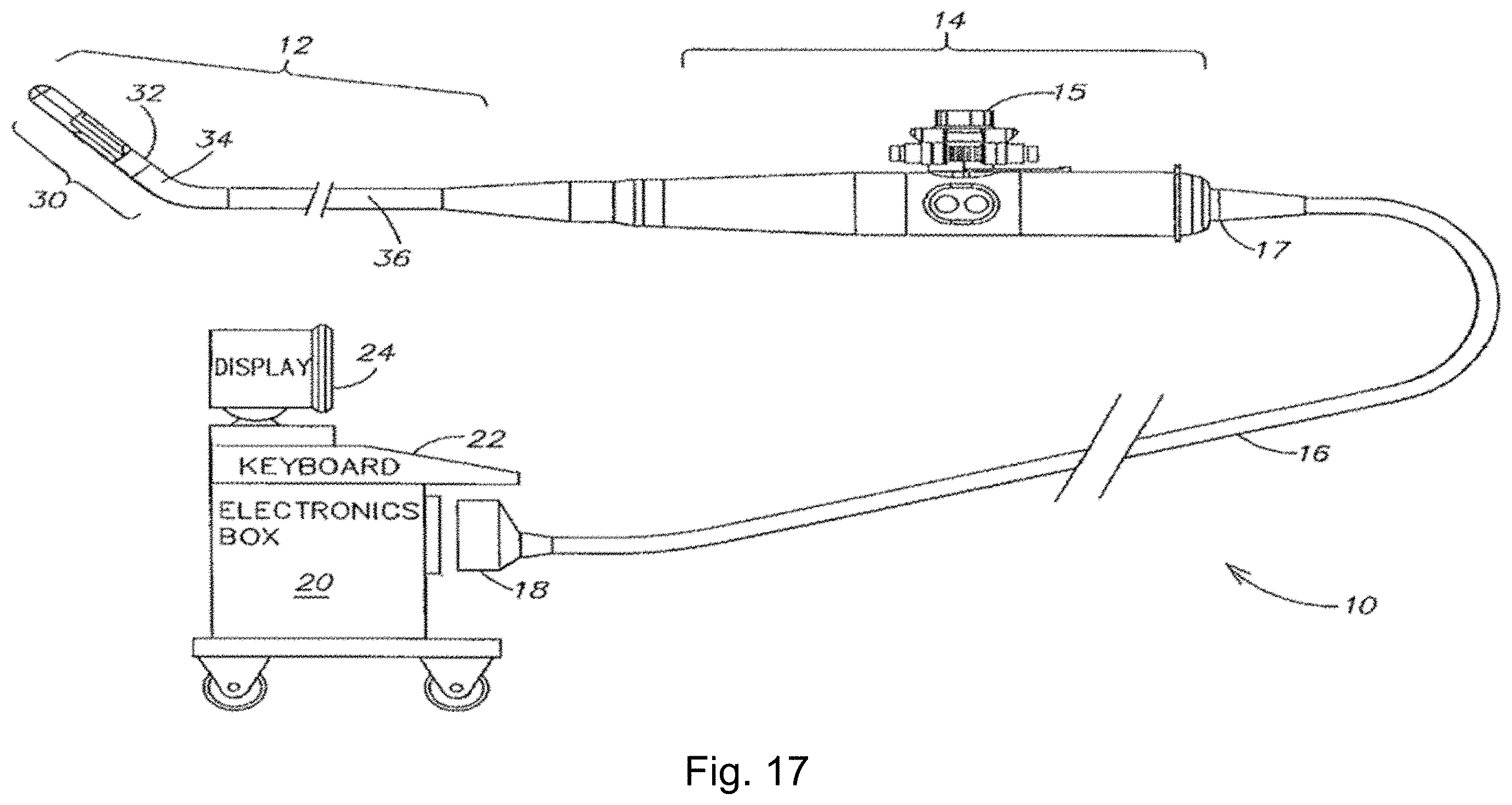 Patent US11793484 Figure 17 – Method, device and system for intracavity probe procedure planning