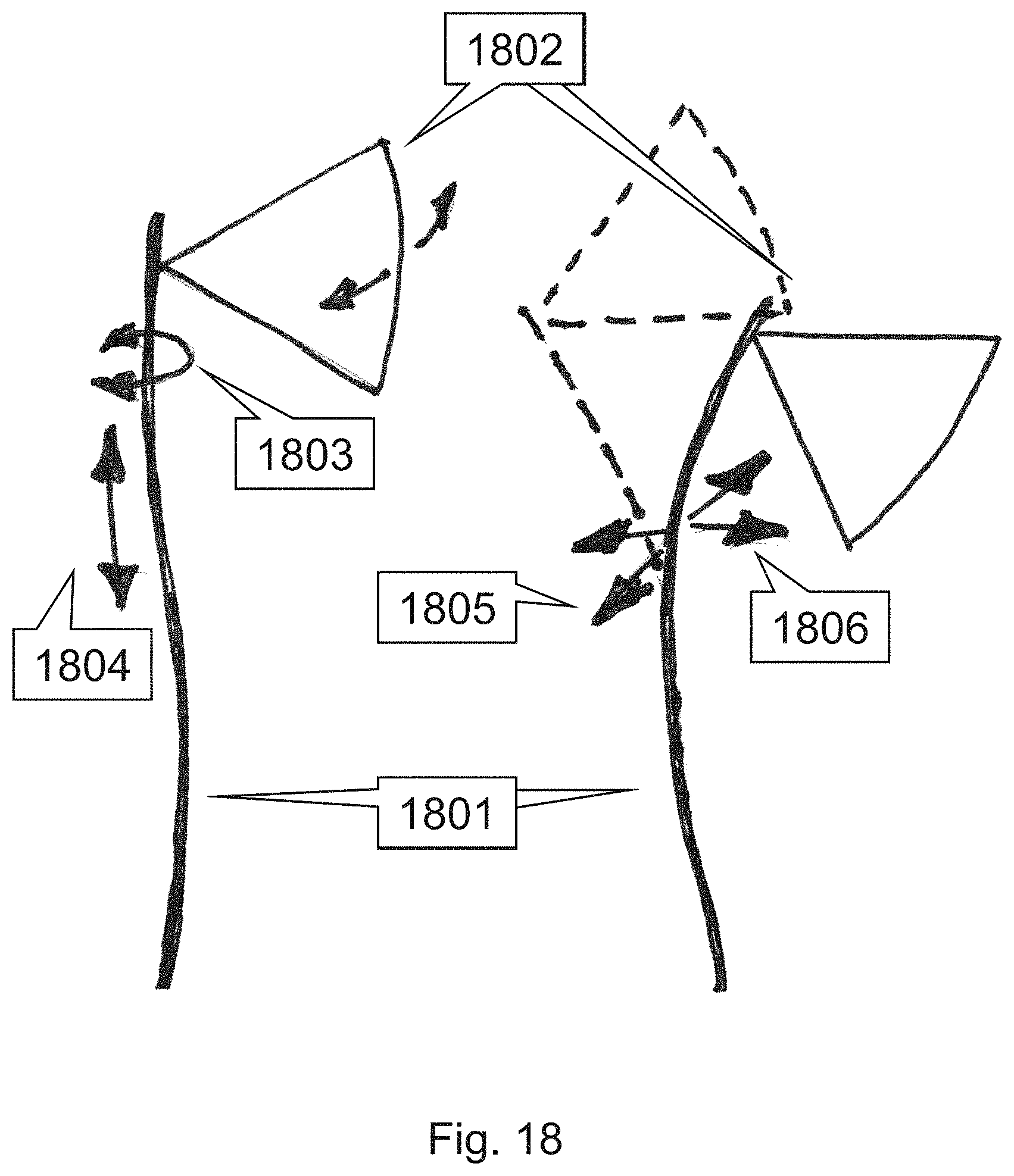 Patent US11793484 Figure 18 – Method, device and system for intracavity probe procedure planning